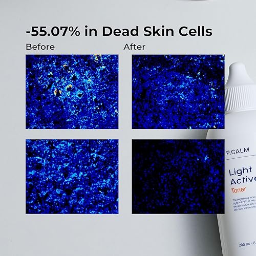Miniatura 5 de PCALM Tóner de piel facial activo ligero para manchas oscuras flacidez hiperpigmentación cuidado del sebo exfoliante regeneración de piel muerta