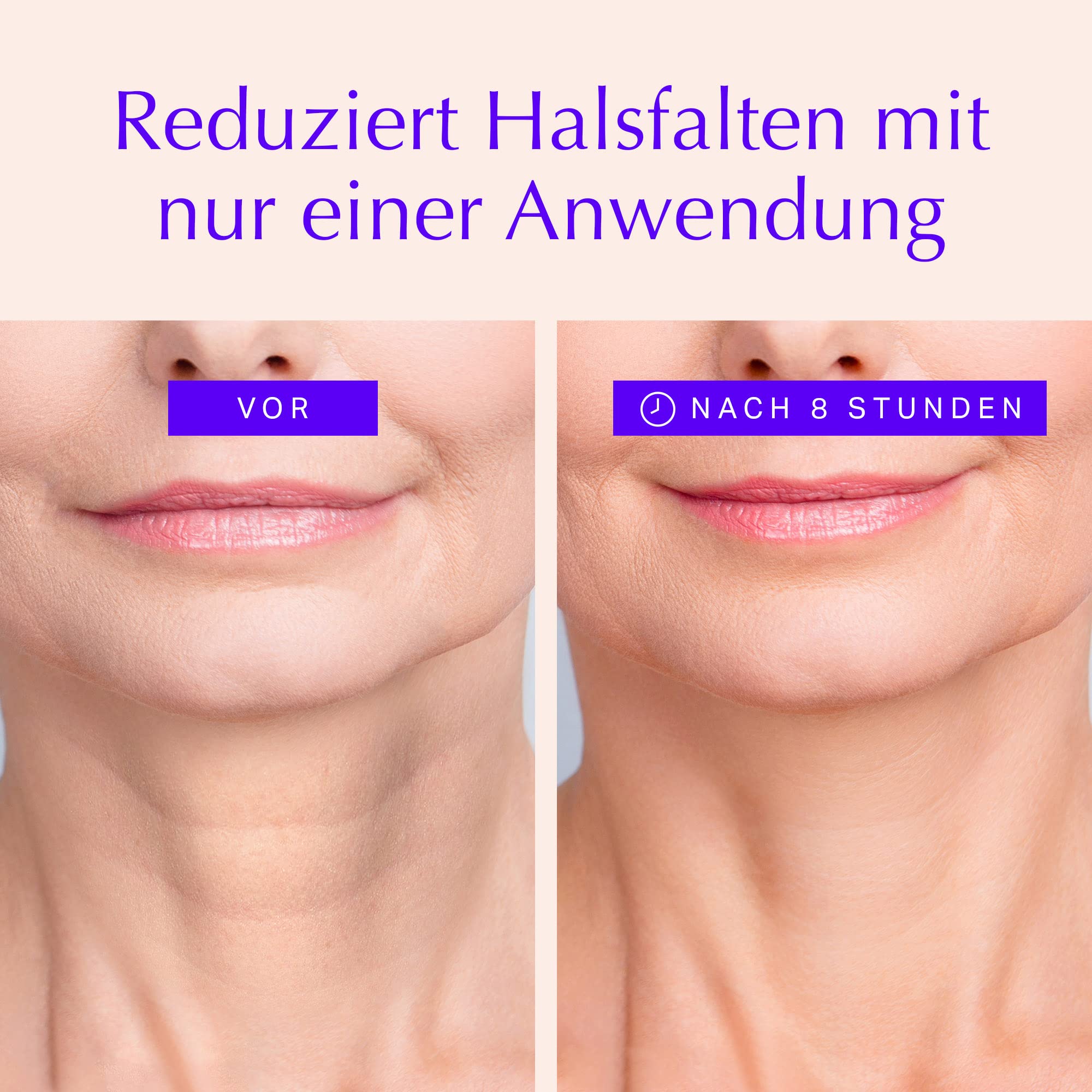Hals Antifalten Pads - Anti-Aging Feuchtigkeitsspendende Straffende Haut-Safe Silikon Hautpflege Schönheit Patches - über Nacht wiederverwendbar Feine Linie Prävention & Lift Colleté (1-mo Supply)