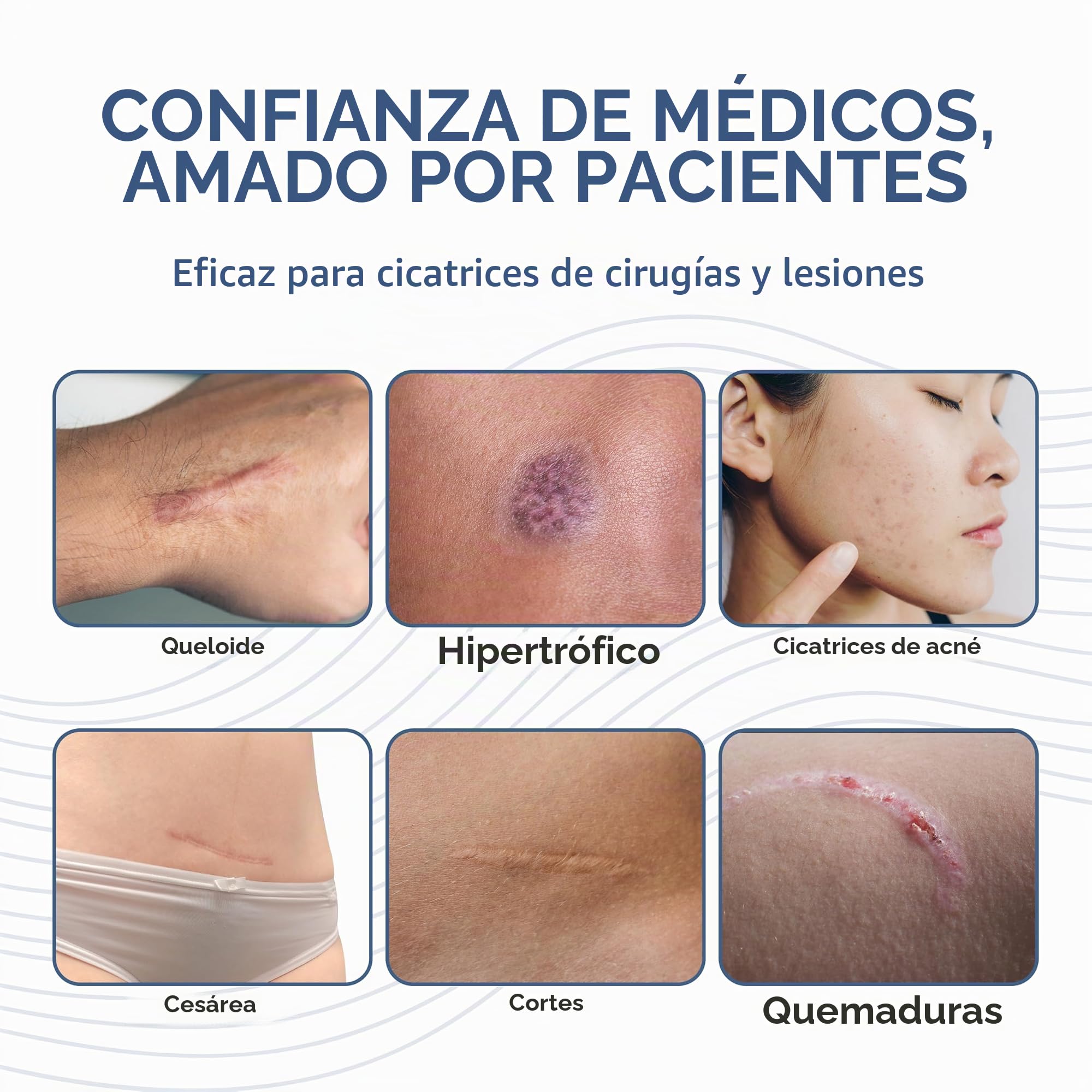BIODERMIS - Stick de Silicona para Cuidado de Cicatrices | Ayuda con Cicatrices y Queloides | Ideal para Uso Diario | Fácil Aplicación, 17 g, Paquete de 1