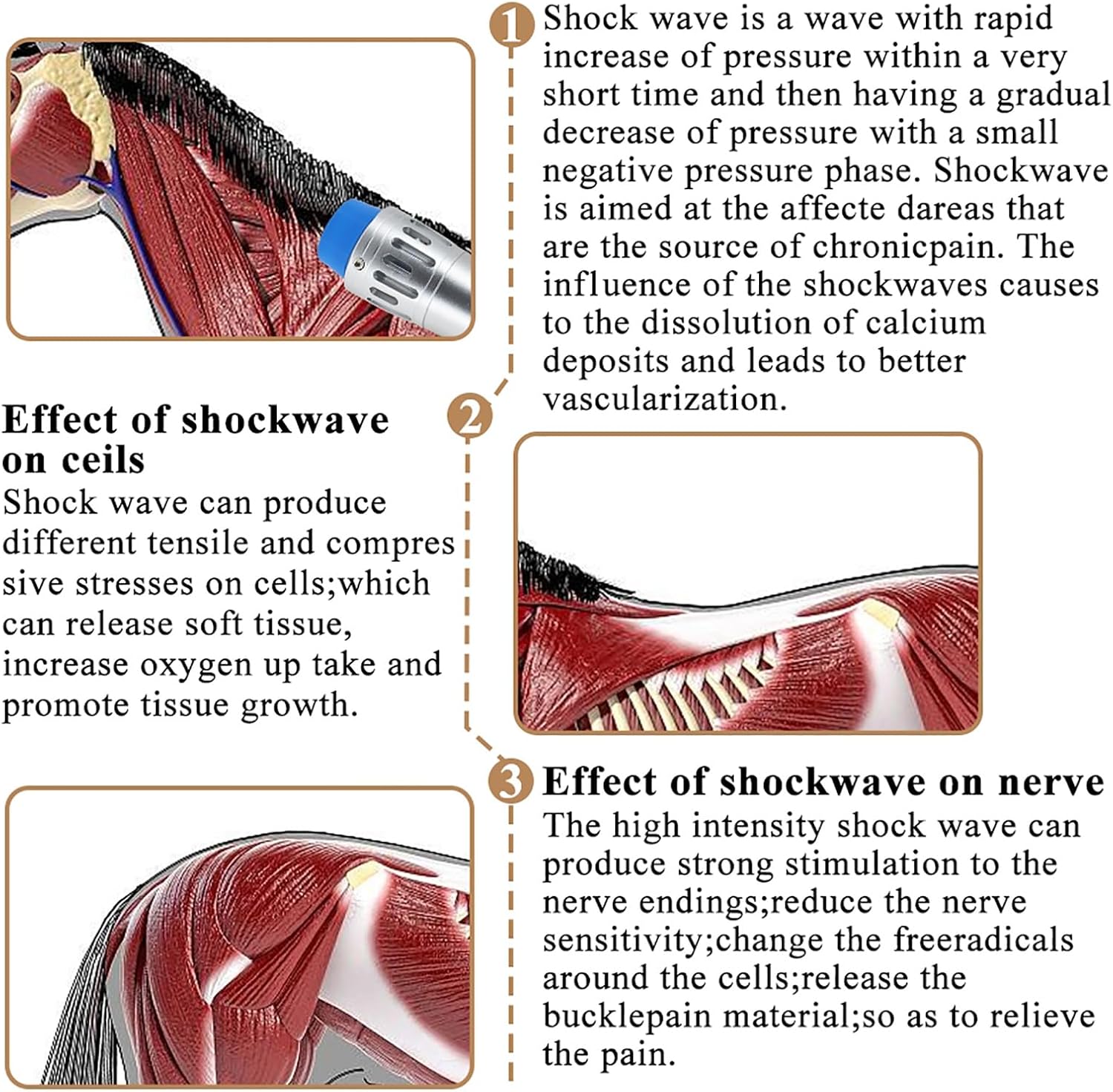 Shockwave Therapy Machine for Horses, 10-300MJ Veterinary Extracorporal Shock Wave Therapy Device, with 7 Deep Tissue Age Heads/Handle Base