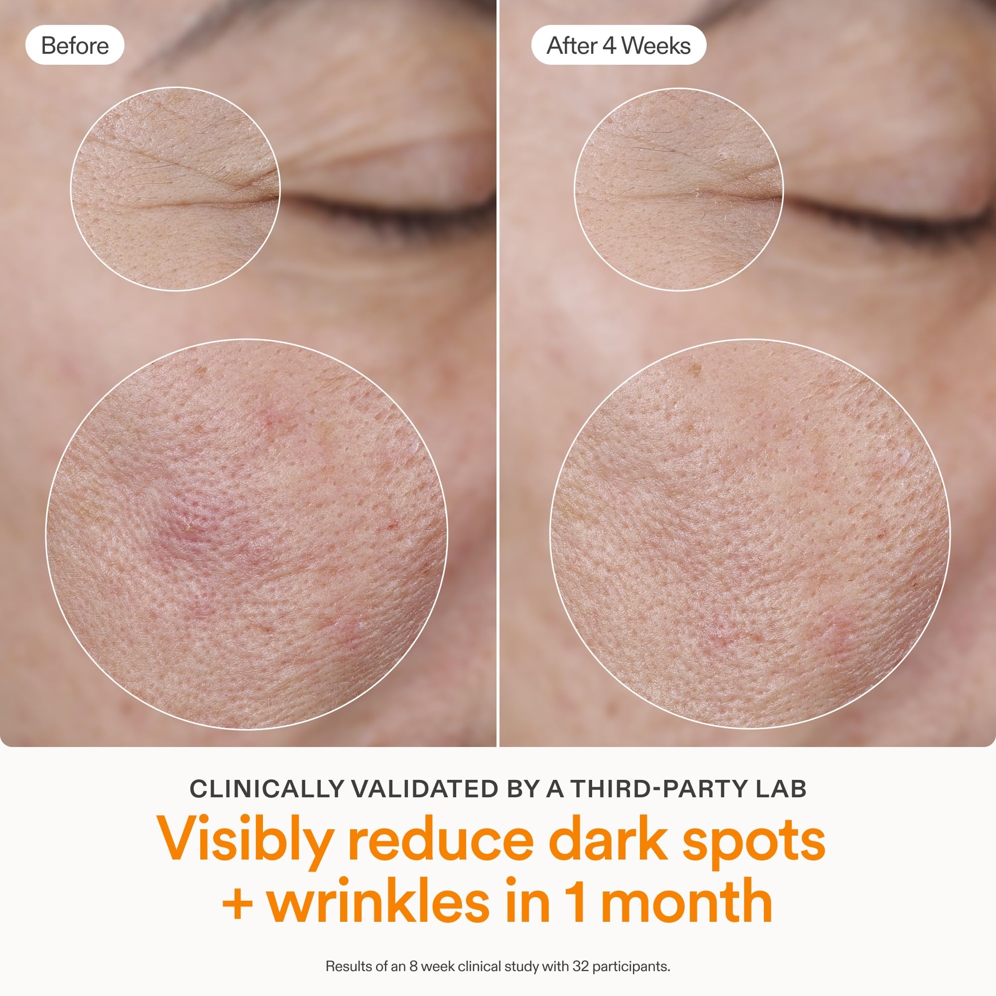 Skinfix Brighten Firm 15% Vitamin C Serum for Face - Visibly Fades Dark Spots & Fine Lines - Safe for Sensitive & Aging Skin product thumbnail 6