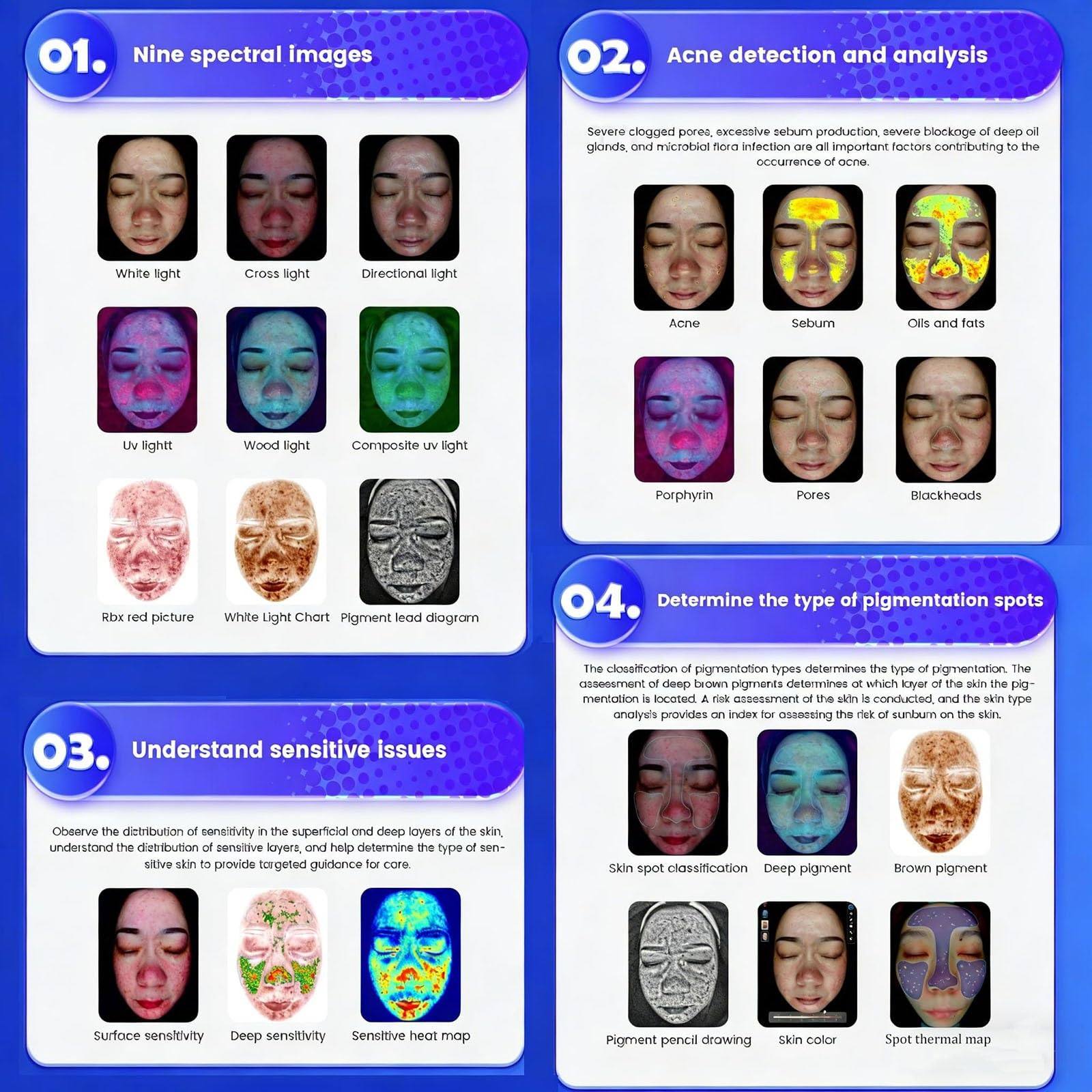 Analizador De Piel, Escáner 2 En 1 para Piel Y Cuero Cabelludo, 9 Imágenes Espectrales, Resolución De 36 Megapíxeles, Análisis De Rostro, Sueño Y Gestión De Informes De Peso 15.6in