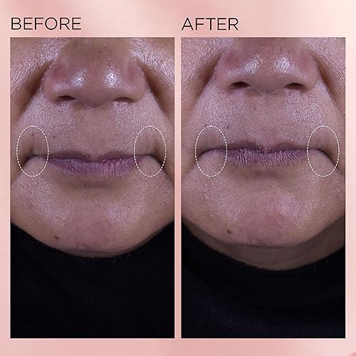 Miniatura 7 de Elizabeth Arden Retinol Serum Wrinkle Filler + HPR Next Generation Retinoid, Ceramide, and Peptide Rapid Skin Renewing Water Day and Night Cream for