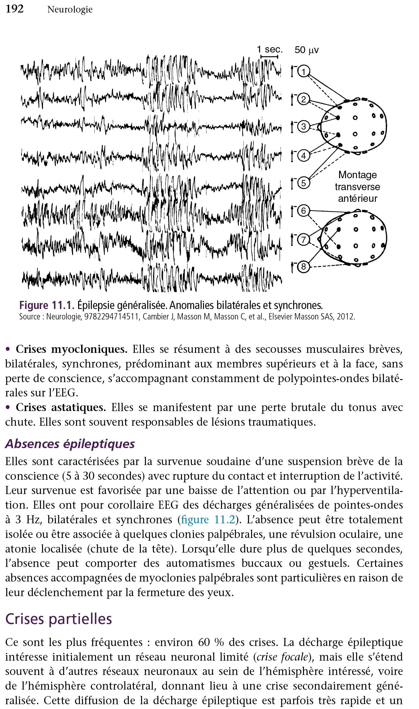 Neurologie