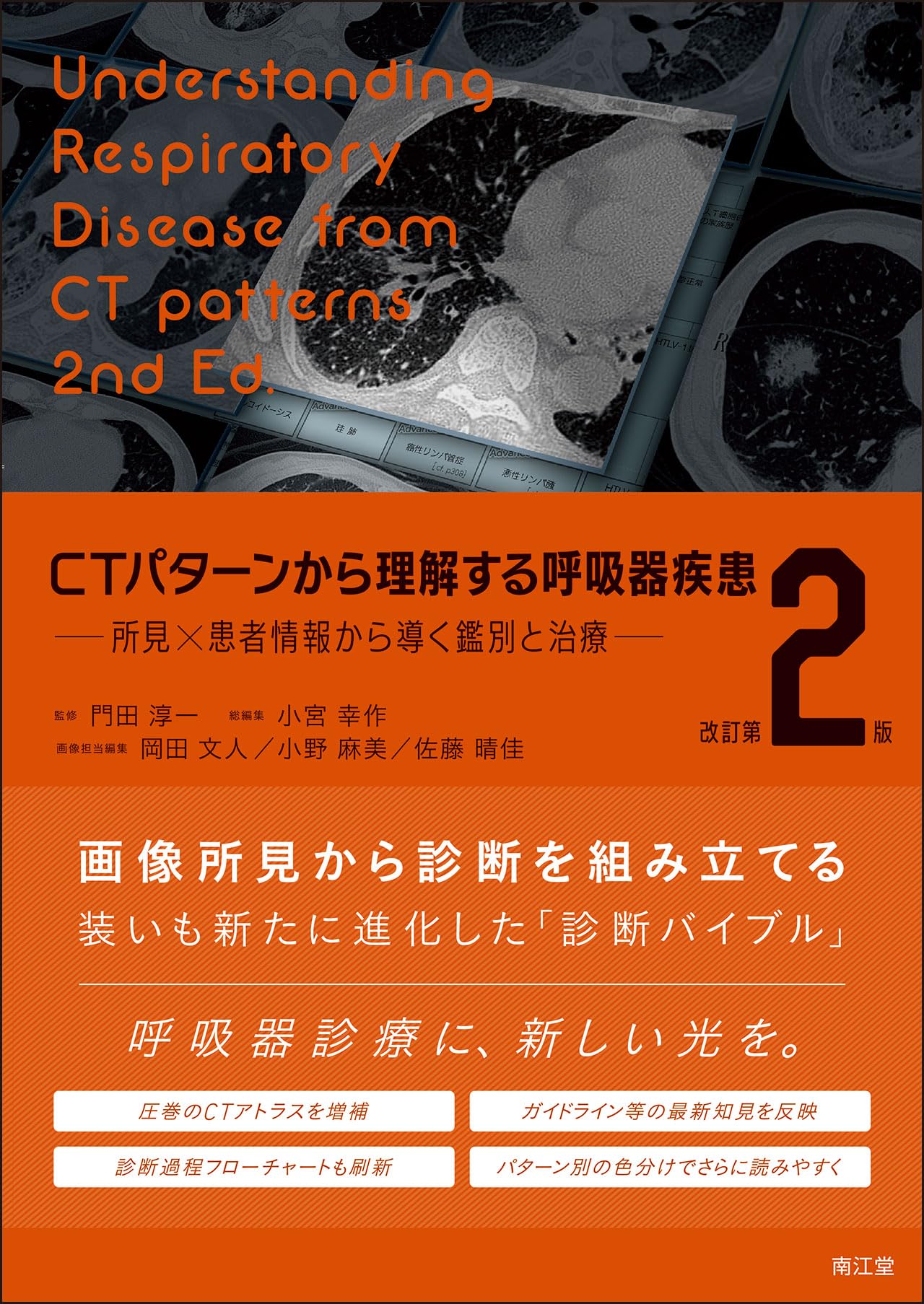 CTパターンから理解する呼吸器疾患: 所見×患者情報から導く鑑別と治療 門田 淳一 CTパターンから理解する呼吸器疾患(改訂第2版): 所見×患者情報から導く