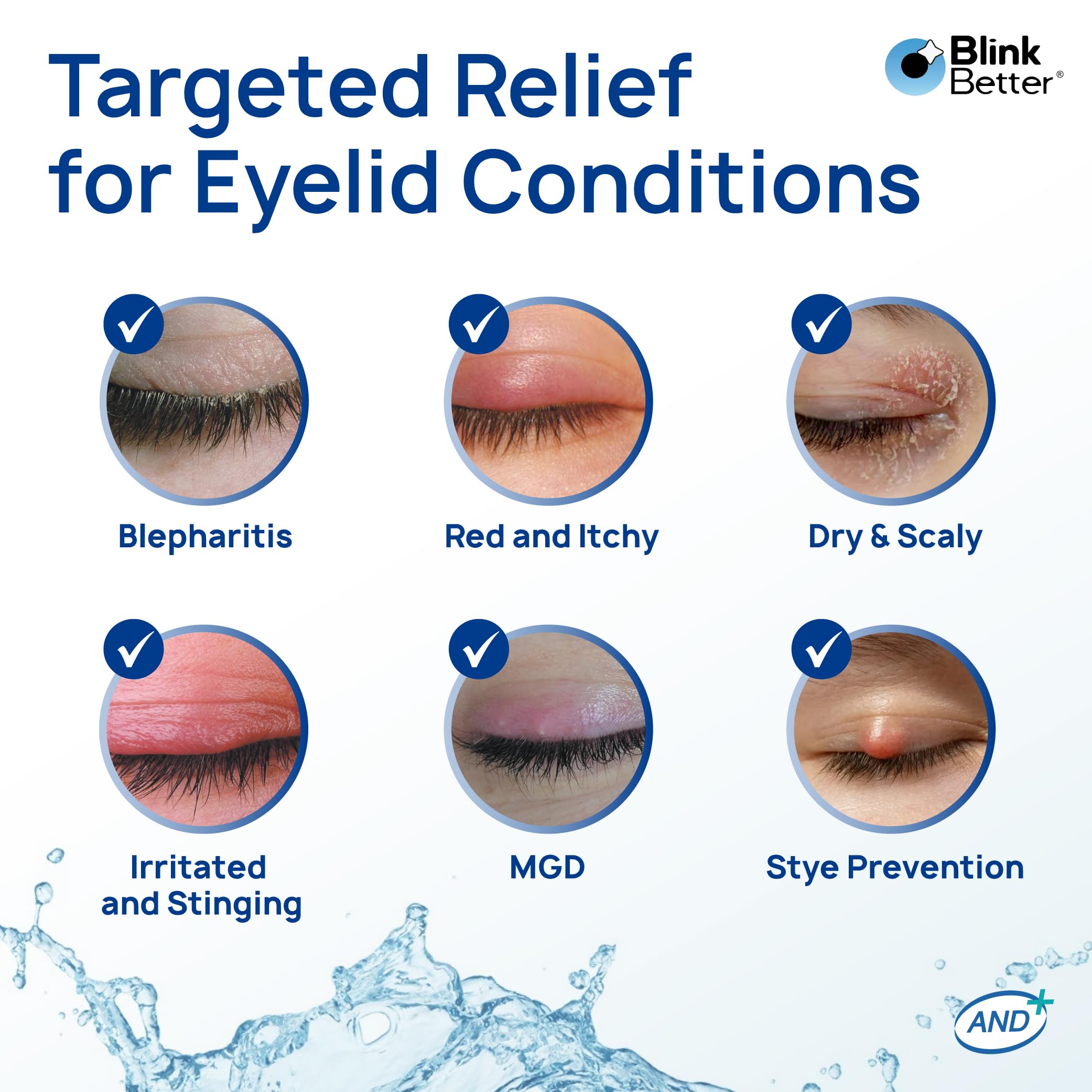 BlinkBetter BetterLids Boosted Hypochlorous Acid Eyelid Spray – Gentle Non-Sting Eyelid Cleanser Mist with Ectoin & Trehalose for Blepharitis, Dry and Itchy Lids – Daily Lid Hygiene Eye Spray, 50 ml — Amazon image 5