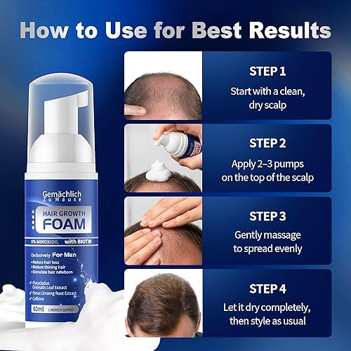 Miniatura 6 de Espuma de crecimiento del cabello de minoxidil al 5 % para hombres adecuada para adelgazamiento del cabello y pérdida de cabello al crecimiento del