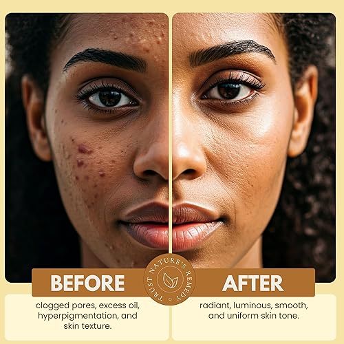 Miniatura 4 de Joli Noir - Exfoliante de cúrcuma con miel y canela - Exfoliante de azúcar facial sin fragancia - Para el acné y la opacidad - 3 onzas