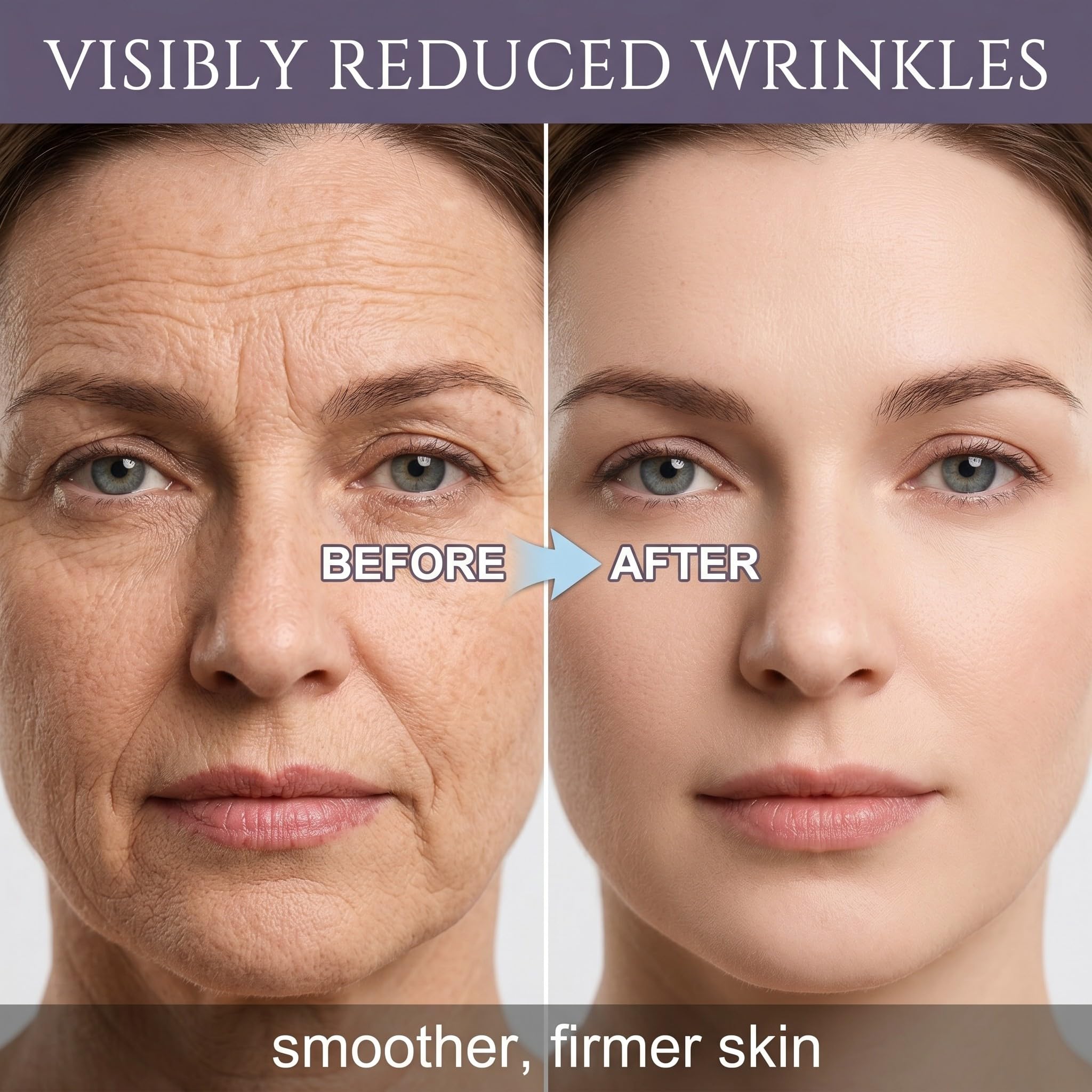 162 Cerotti Antirughe Viso e Fronte, Patch Antirughe Trasparenti per Donna, Trattamento Notturno per Linee Sottili, Rughe Nasolabiali e Contorno Occhi, Effetto Lifting Naturale