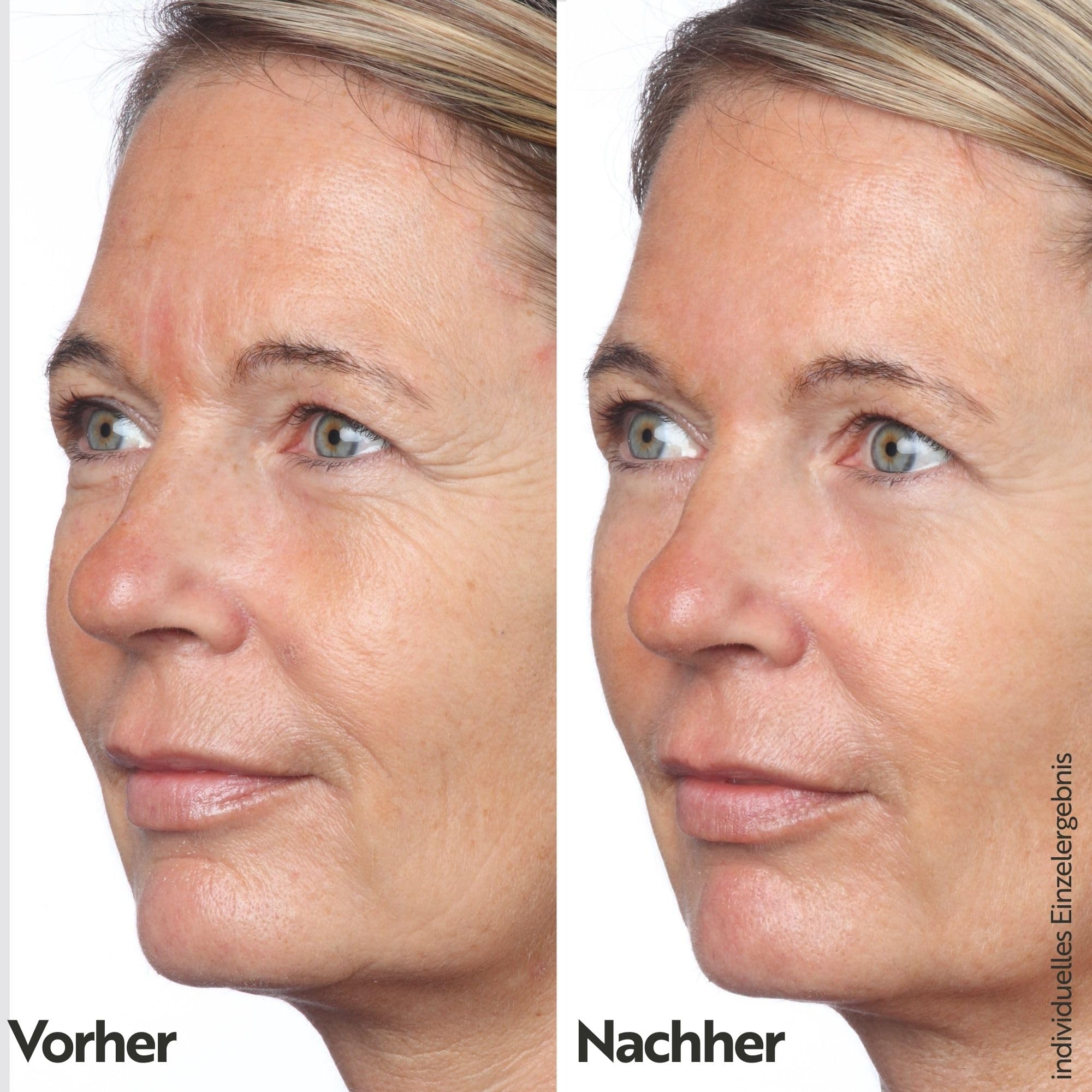 M. Asam Vinolift Spezial Nachtpflege (100 ml) | Reichhaltige Nachtcreme zur Regeneration reifer Haut, Anti Falten Creme Mit Hyaluron, Resveratrol und Traubenkernöl