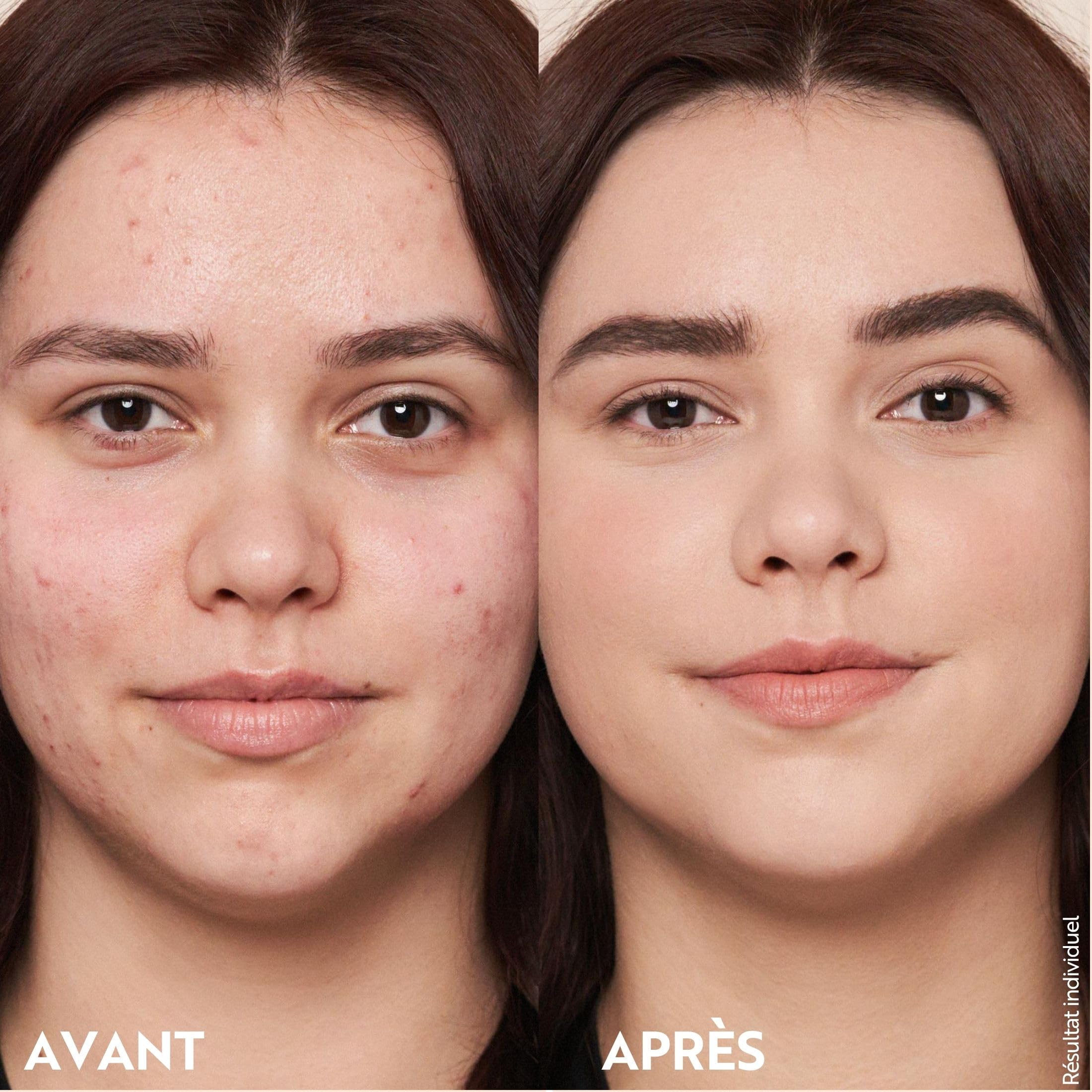 M. Asam MAGIC FINISH Fond de Teint Mousse Classic (30ml), une Base Maquillage 4-En-1 : Primer, Make Up, Poudre & Anti-Cernes, Fond de Teint Naturel & Léger pour Tout Type de Peau, Végétalien