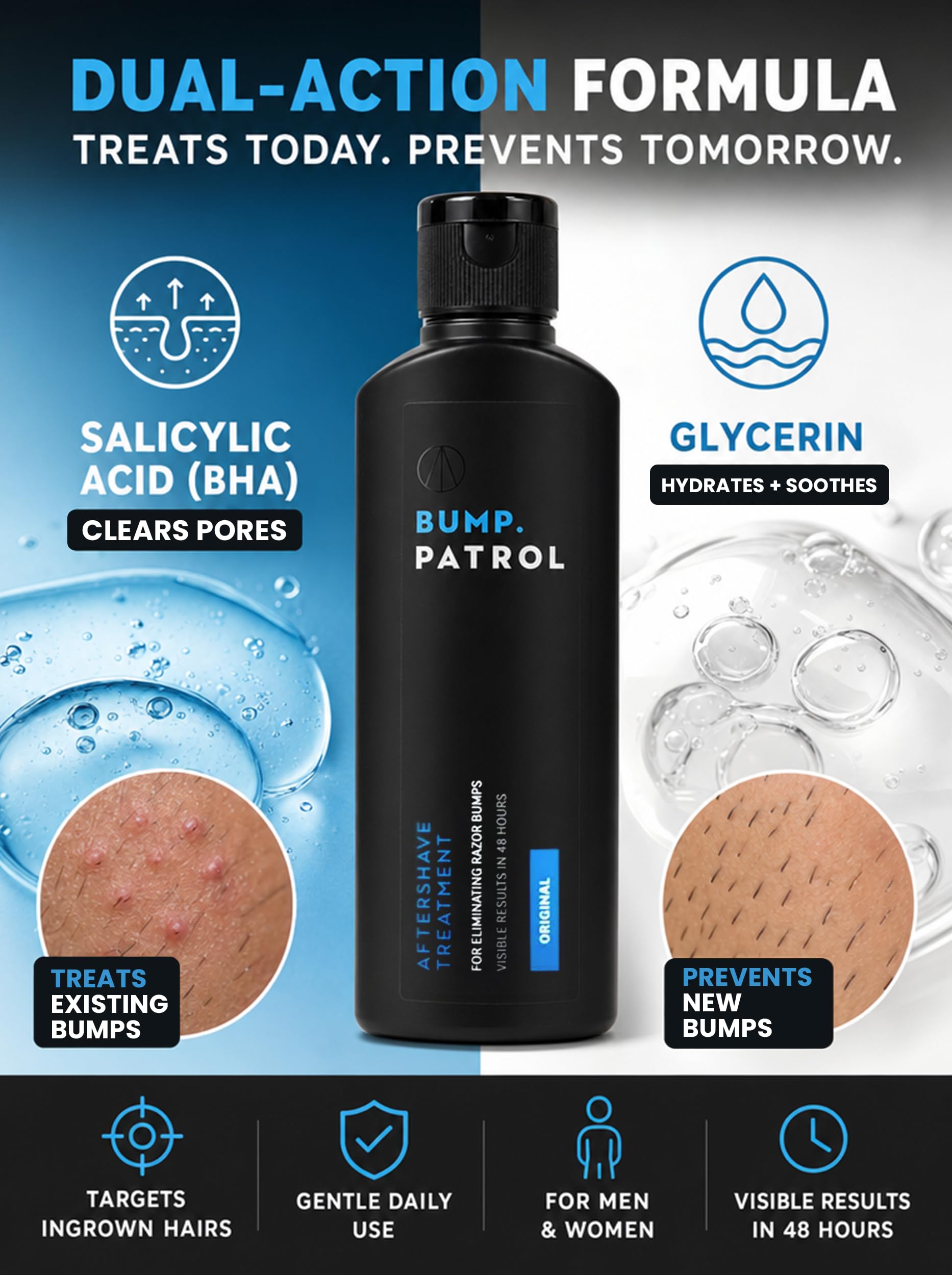 Bump Patrol After Shave 60 ml Intensive Treatment (Packung mit 2)