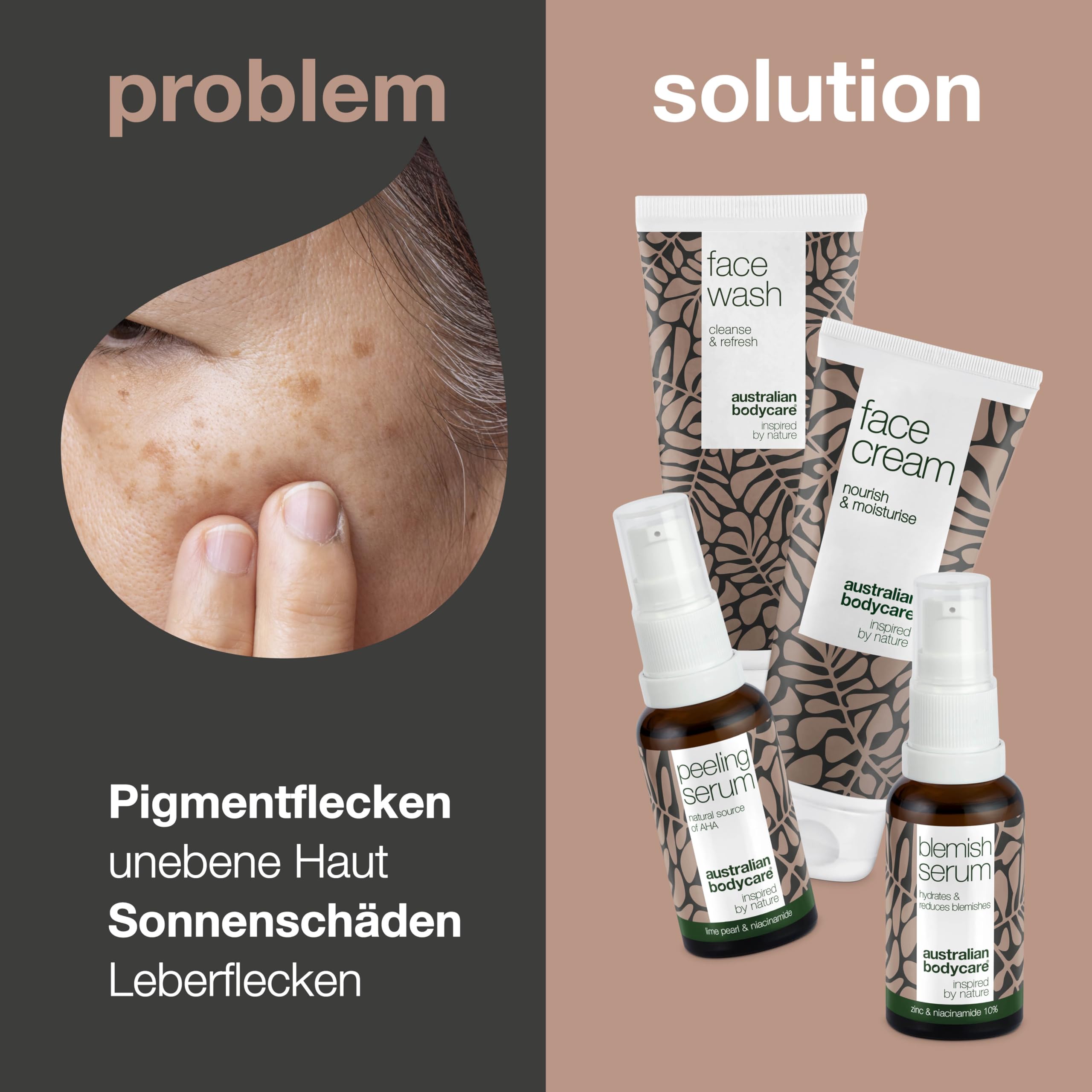 Reduziere Pigmentprobleme im Gesicht mit dem 4-teiligen Set bestehend aus Gesichtsreinigung 200ml, Niacinamid Serum, Peeling Serum und Gesichtscreme 100ml speziell für Pigmentflecken im Gesicht