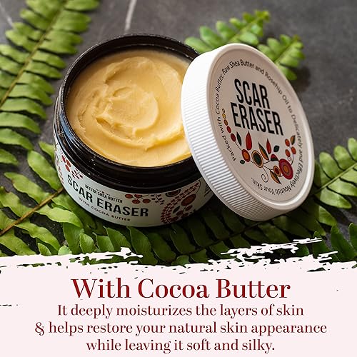 Miniatura 6 de Better Shea Butter - Mantequilla corporal para eliminar o reducir la apariencia de cicatrices, estrías, marcas de quemadura, cicatrices de acné,