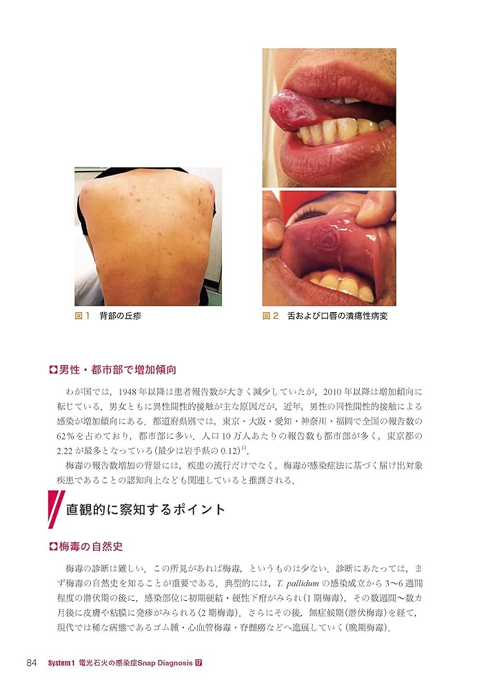 病歴と身体所見から感染症を見極める (臨床感染症ブックレット 1) 病歴と診察で診断する感染症: System1とSystem2 | 志水太郎