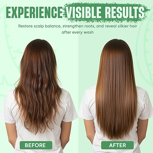 Miniatura 6 de Juego de champú y acondicionador de aloe vera con aceite de batana, fórmula hidratante, calmante y de equilibrio de humedad para cuero cabelludo