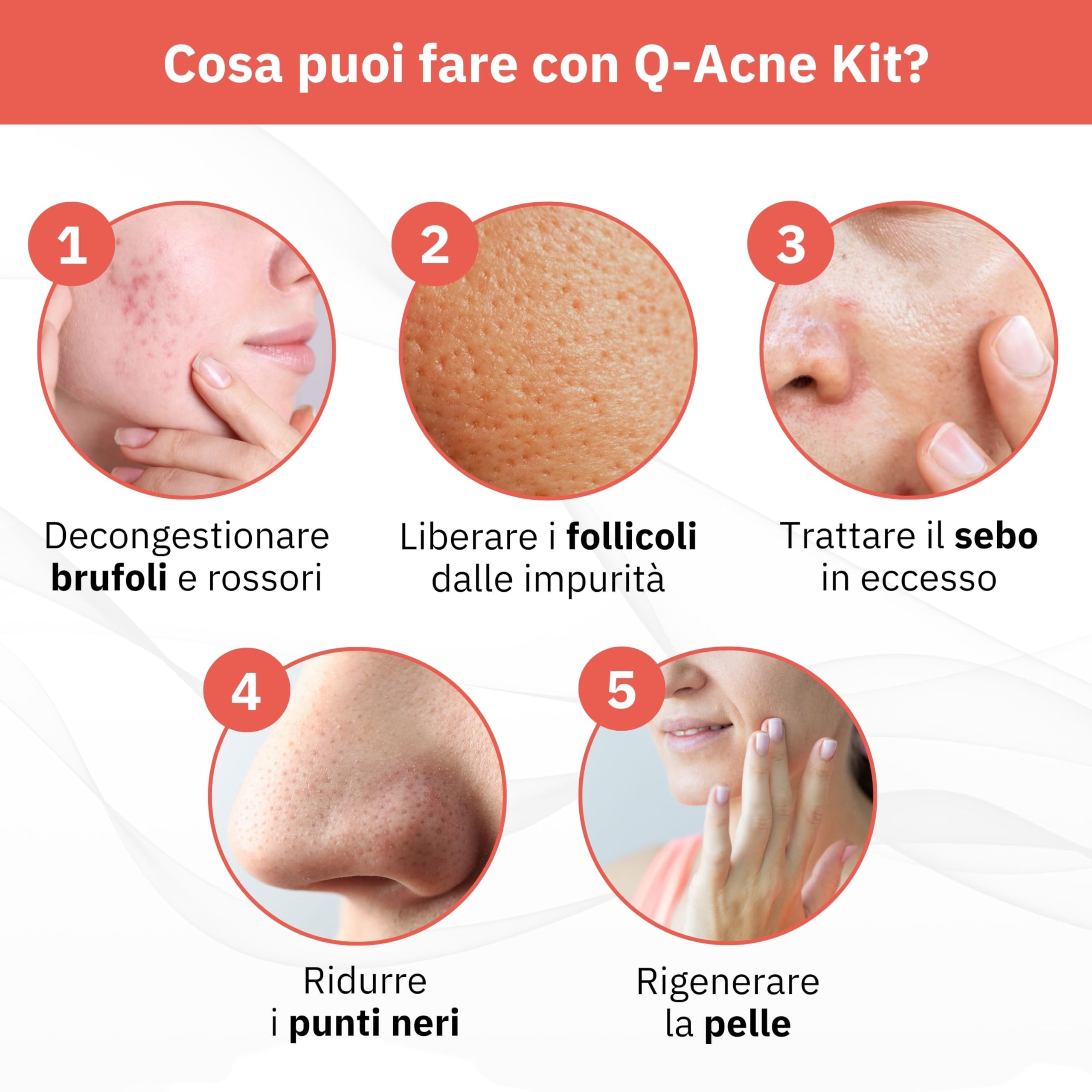 Q-Acne Complex Kit Completo per Trattamento Acne, Crema Acido Salicilico Viso e Sapone Detergente