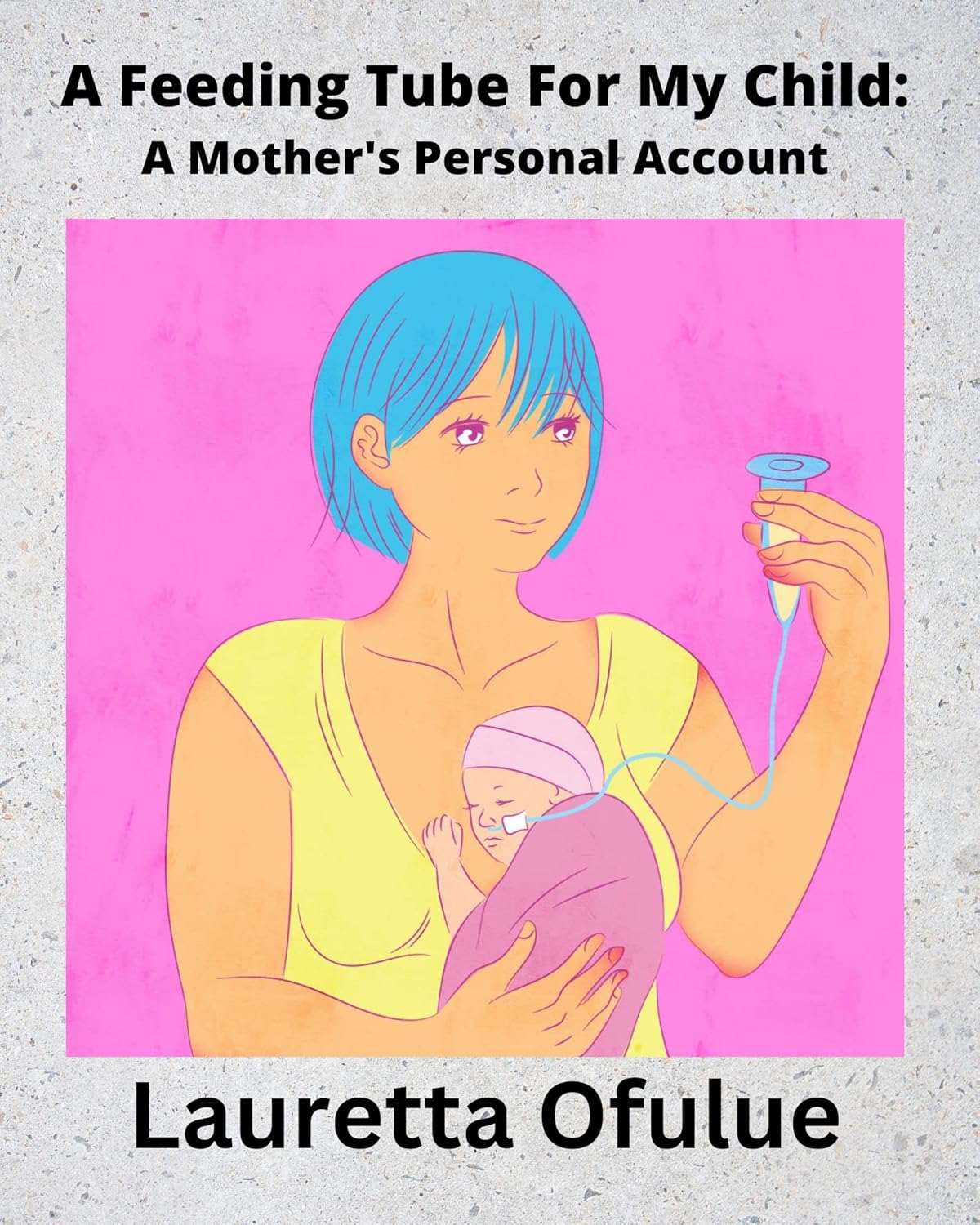 A Feeding Tube For My Child A Mother’s Personal Account (English