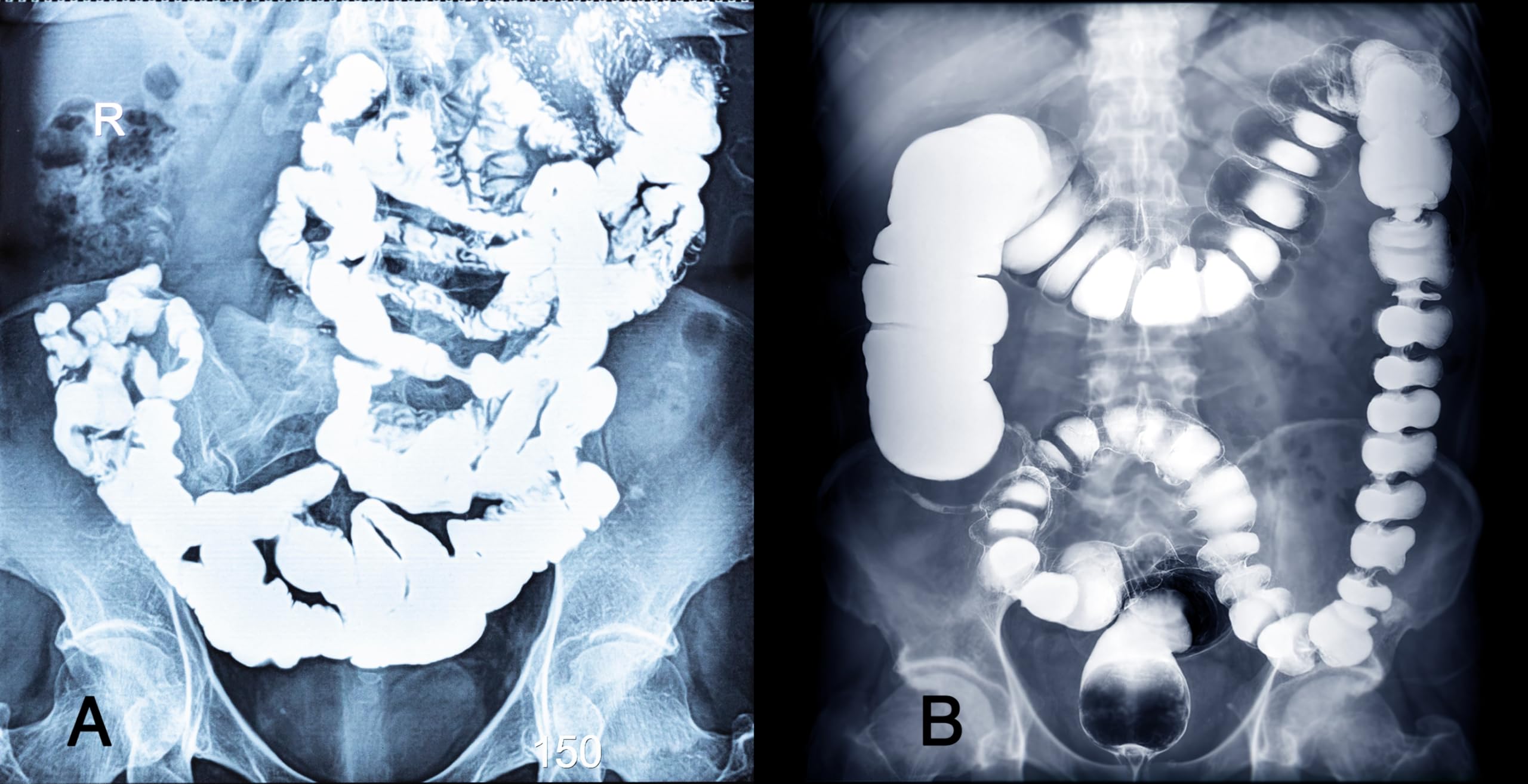 Gastroenterology Made Ridiculously Simple