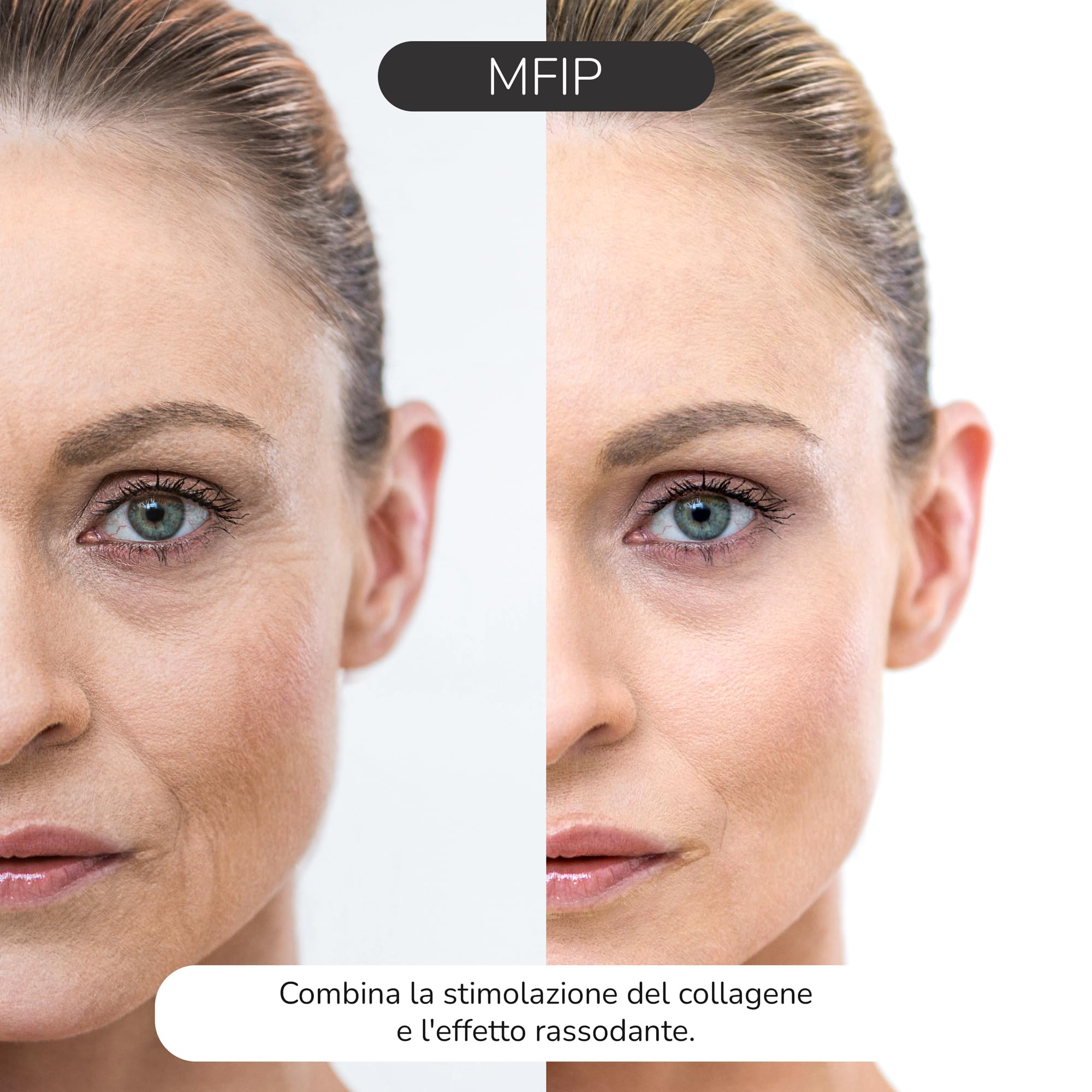 Illume 2nd Gen Radiofrequenza viso et Massaggiatore Viso, Dispositivo antirughe con radiofrequenza viso professionale per Lifting Viso e Cura Anti-età