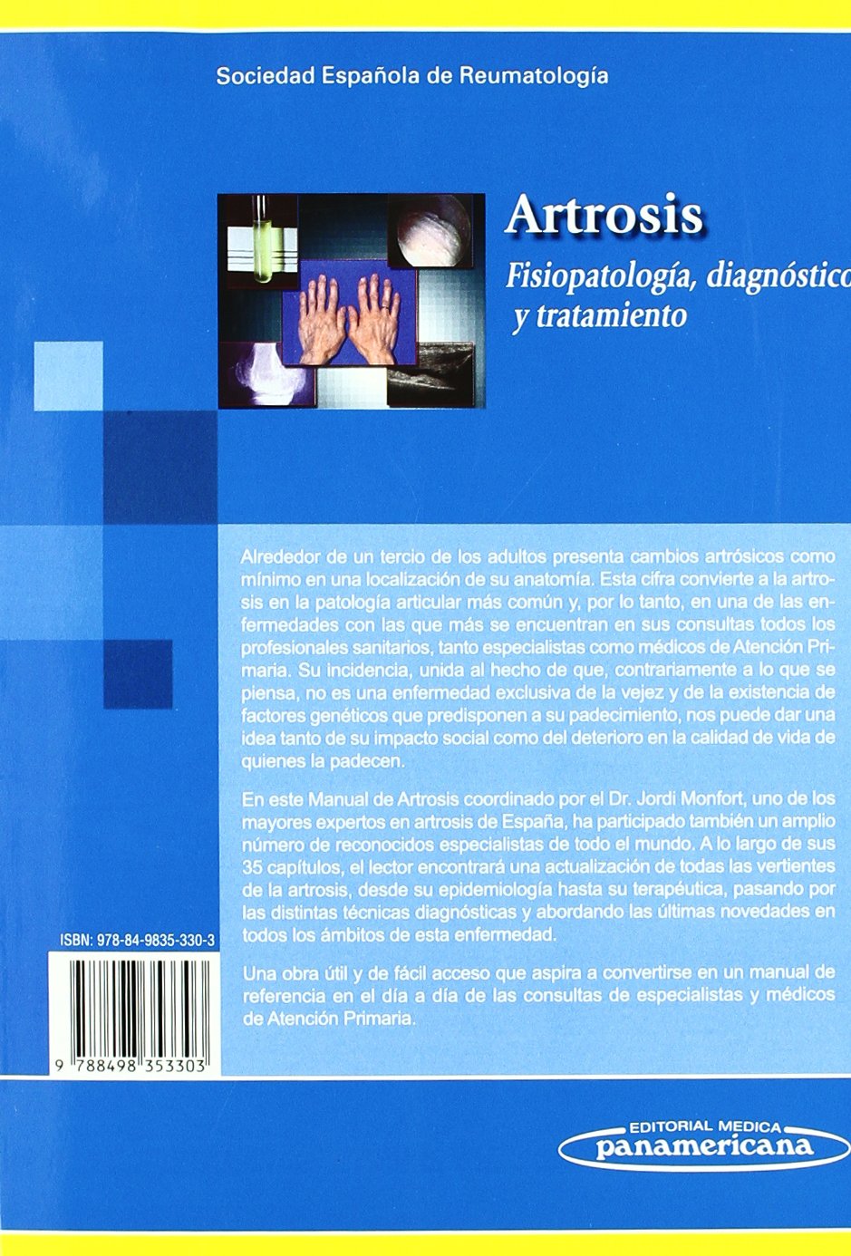 Artrosis