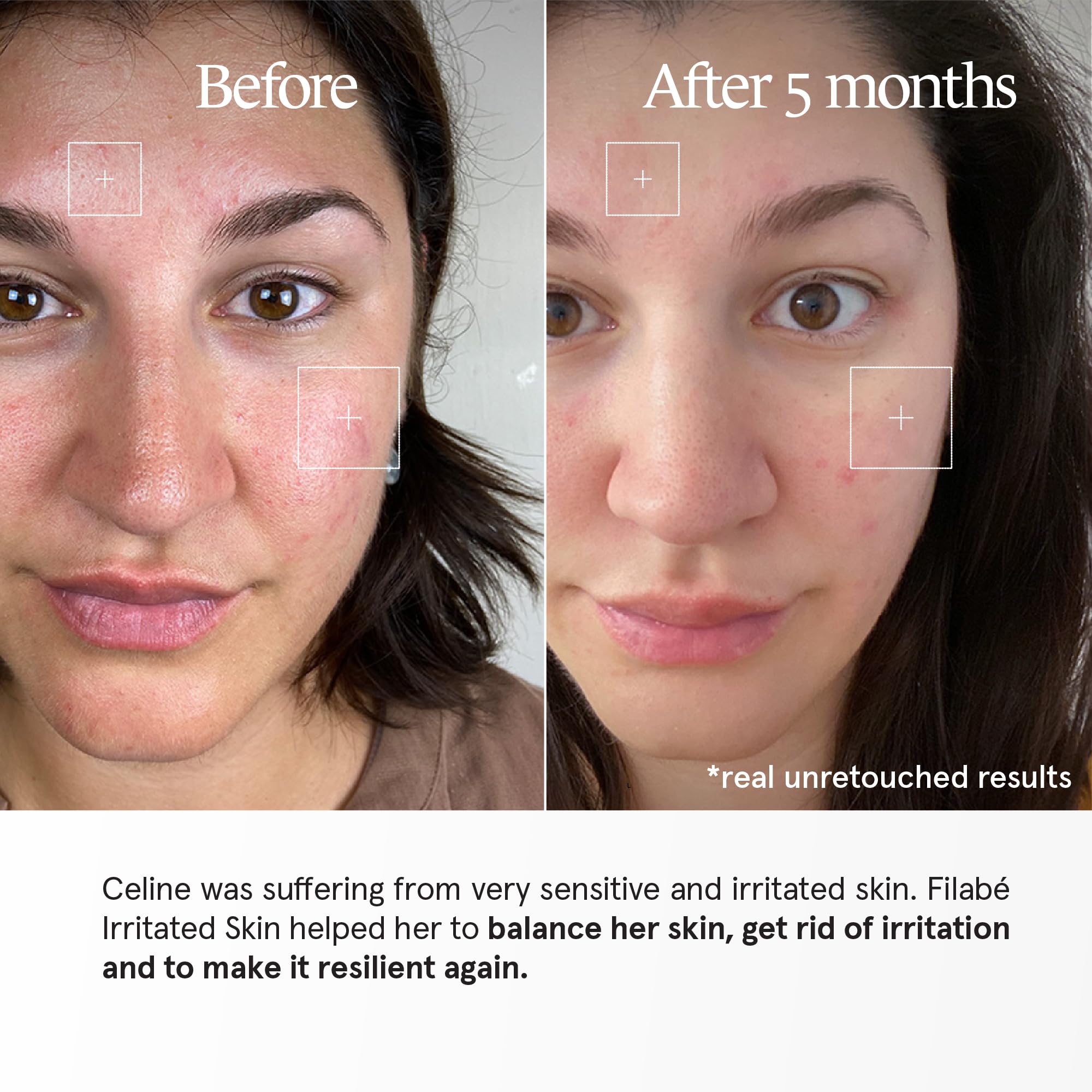 of Switzerland – Irritated Skin – pielęgnacja twarzy dla bardzo wrażliwej skóry z zaczerwienieniami i suchymi, podrażnionymi miejscami, opakowanie z 28 zastosowaniami, wegańska i bez dodatków, Szwajcaria made