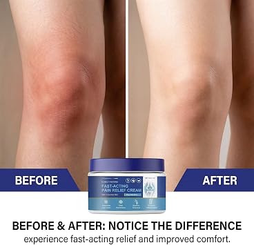 Joint Relieving Gel Joint Care Cream Hyaluronic Acid Knee Relief Cream Eases Stiff Joints & Sore Muscles Non-Greasy Formula for All Skin Type 30g