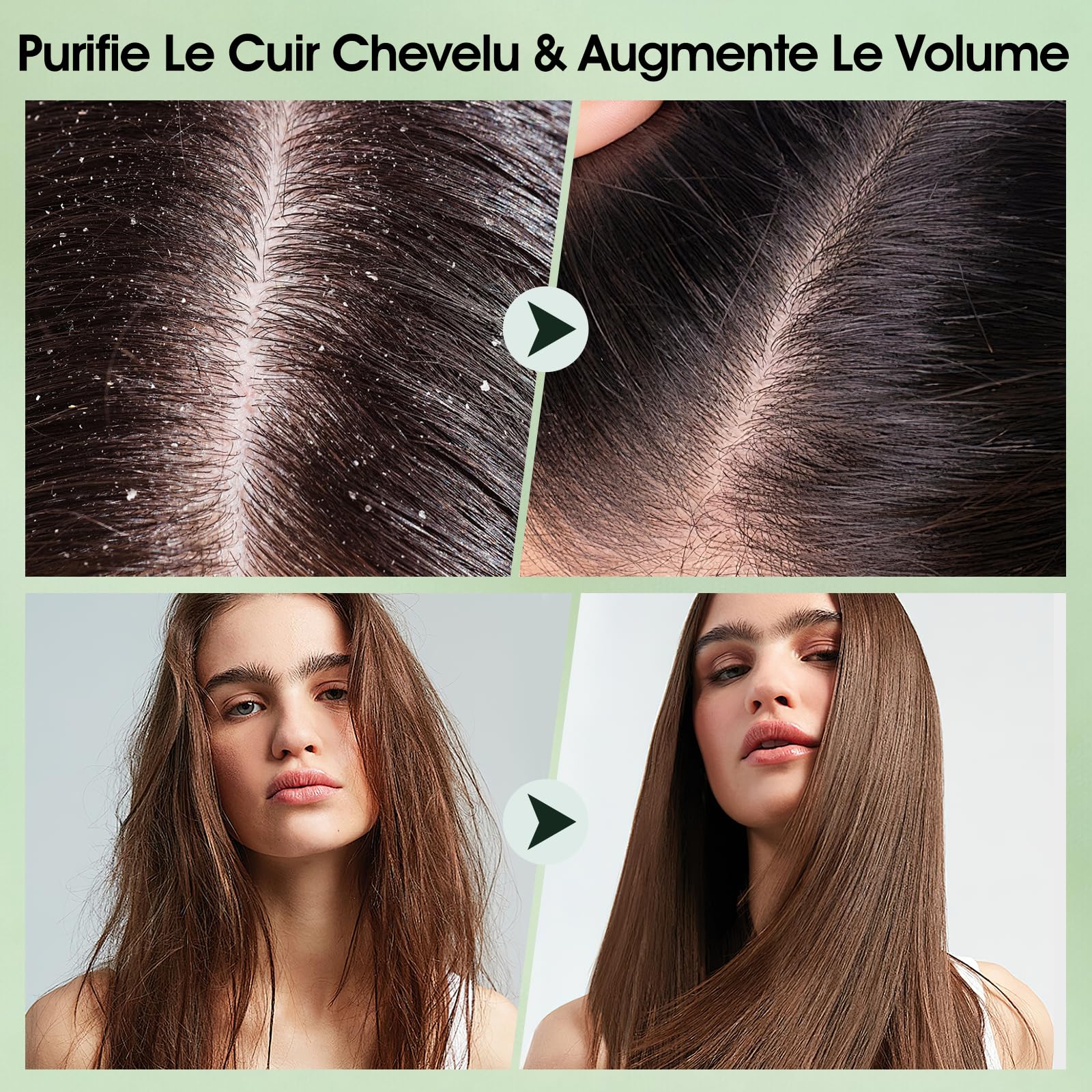 Shampoing exfoliant pour cuir chevelu 2 en 1 à l'huile de menthe, soin des cheveux pour clarifier et éliminer les dépôts avec masseur de cuir chevelu en silicone, 300 g