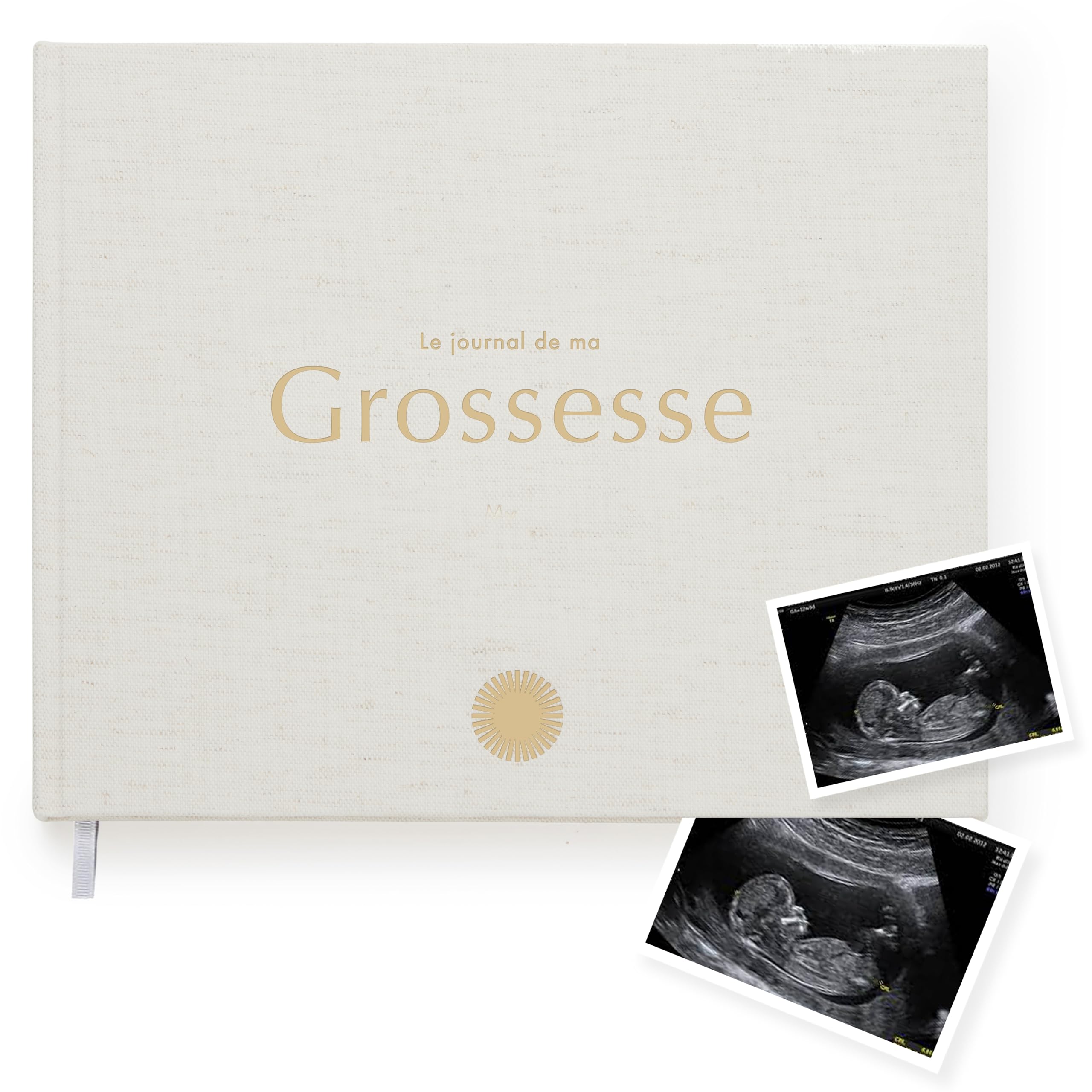 Your Edition Journal de grossesse – Livre de souvenirs de bébé pour les futures mamans – Livre de grossesse de luxe – Planificateur de grossesse – Cadeau de grossesse pour la première fois – Avec