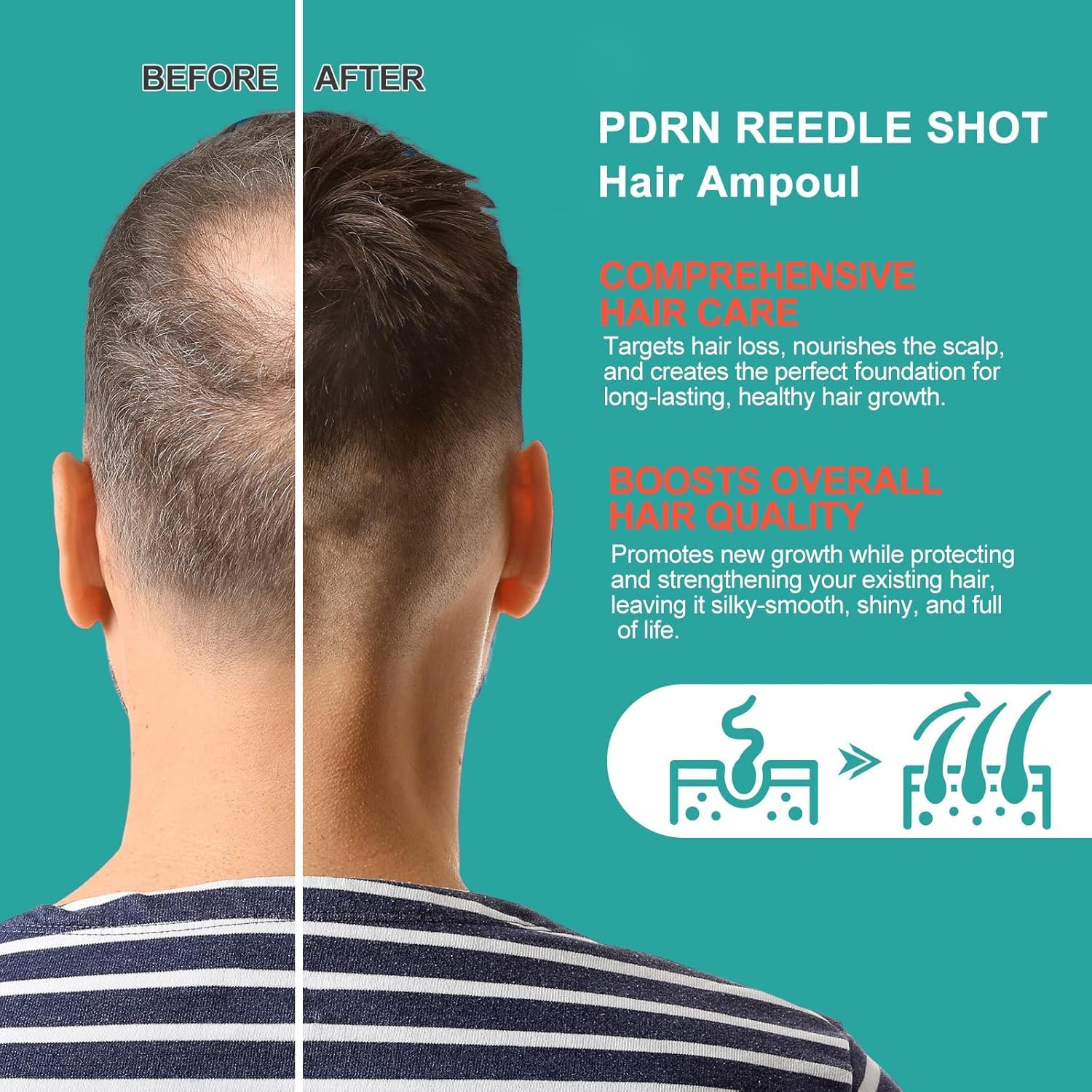Sérum capillaire quotidien pour le cuir chevelu, sérum anti-chute, nourrit les follicules pileux, fortifie les racines et améliore la résistance des cheveux.