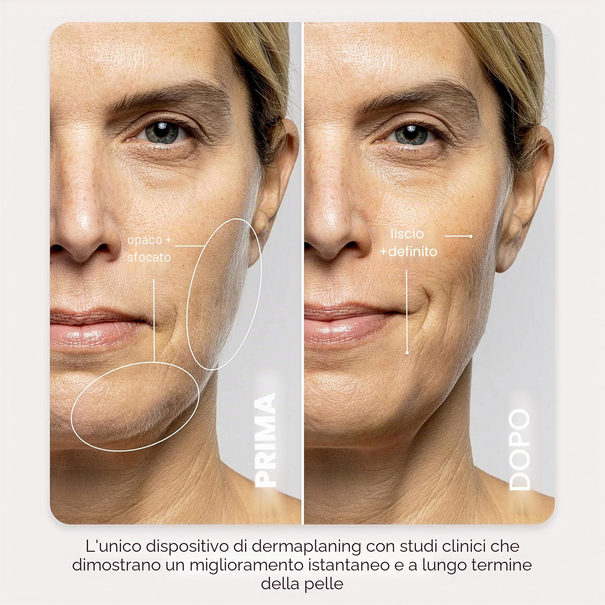 DERMAFLASH Dispositivo LUXE Plus, Anti Aging, Esfoliazione, Depilazione e Strumento Dermaplaning con tecnologia Sonic Edge e 4 settimane di trattamento, Blush