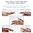 3-Point Products Oval-8 Finger Splint, Support and Protection for Arthritis, Trigger Finger or Thumb, and Other Finger Conditions, Size 10 (Pack of 3)