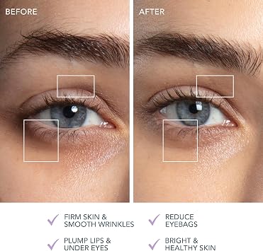 FOREO Bear 2 Eyes & Lips, Microcurrent Line Smoothing Instant Face Lift, Eye Care Device, Brow Lift, Dark Crcles Under Eye Treatment & Lip Plumper Device, Firming Beauty Products, Lavender | Microcurrent Device, Eye Massager, Lip Plumper, Face Lift, Dark Circles, Brow Lift, Firming, Skin Care Tools