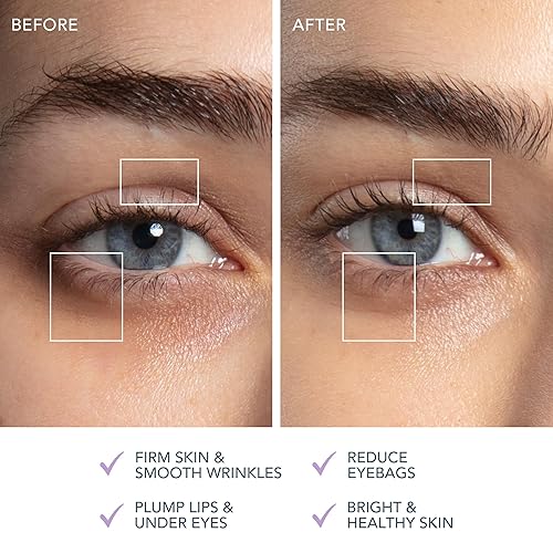 Miniatura 5 de FOREO Bear 2 Eyes & Lips - Microcurrent Line Smoothing Instant Face Lift - - Dispositivo de cuidado de ojos - Lifting de cejas - Tratamiento de