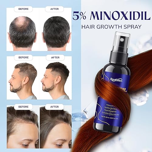 Miniatura 4 de Crecimiento del cabello de minoxidil al 5% para hombres y mujeres paquete de 2 sueros de tratamiento de pérdida de cabello minoxidil extra fuerte
