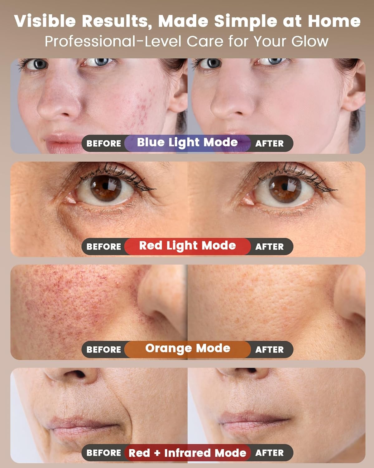 Red Light Therapy for Face Wireless with 400 Leds, 360° Led Face Mask Light Therapy with 4 Modes & Near-Infrared, 2000mAh Rechargeable Led Face Mask with Eye Protection for Anti-Aging & Radiant Glow