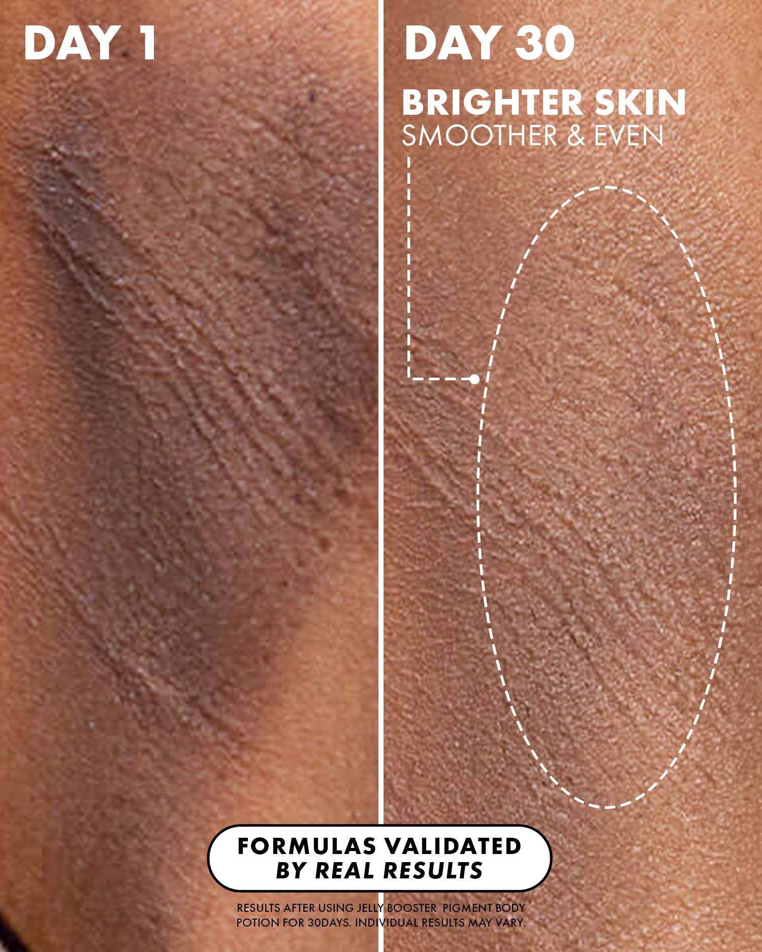 Truly Beauty Jelly Booster Pigment Body Potion, Lightweight, Fast Absorbing Acne Scar Treatment for Face And Body, Scar Removal Ointment/Serum for Everyday Use, 3.1 Fl.Oz