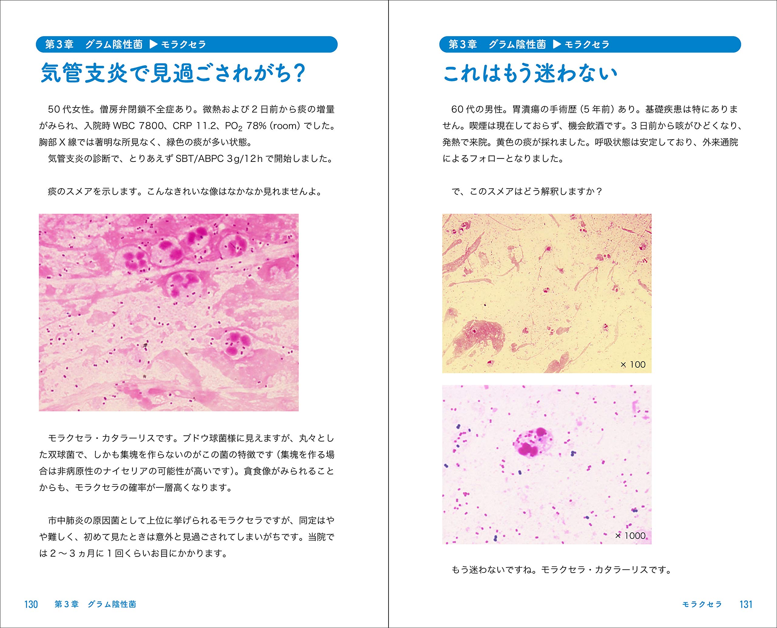 Amazon Co Jp グラム染色道場 肺炎診療に生かす喀痰グラム染色の見方 考え方 山本 剛 Japanese Books
