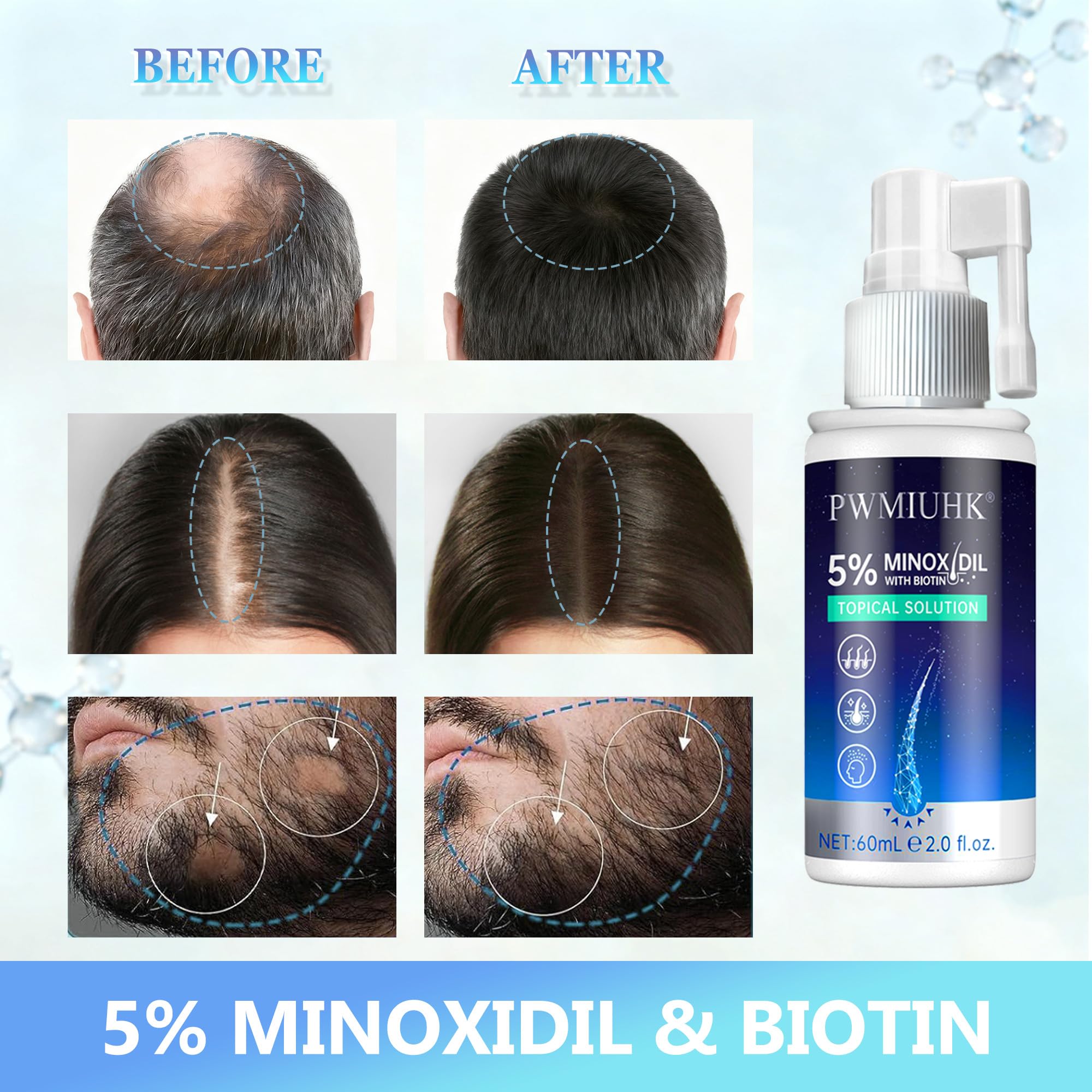 5% Minoxidil for Men & Women, Hair Beard Growth Spray with Biotin, Minoxidil Hair Growth Serum for Hair Regrowth, for Hair Loss & Thinning, make Hair Stronger Thicker -2 fl.oz /60ml — view 8