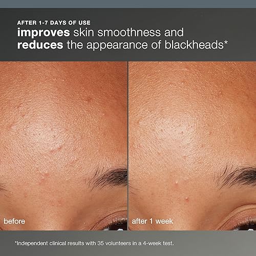 Miniatura 14 de Dermalogica Exfoliante facial diario microfoliante con ácido salicílico y enzima de papaya, logra una piel más brillante y suave todos los días