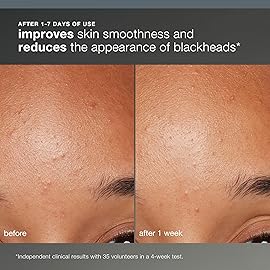 Dermalogica Daily Microfoliant, Face Exfoliator Scrub Powder with Salicylic Acid and Papaya Enzyme, Achieve Brighter, Smoother Skin Daily