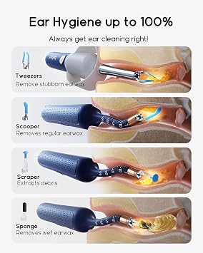 Bebird Earsight Plus R37R Ear Wax Removal Tool Camera, FSA HSA Eligible Items, Smart Ear Cleaner with Painless Visual Tweezers, Flexible Ear Camera Otoscope, Home ENT Cleaning Kit for Family,Blue
