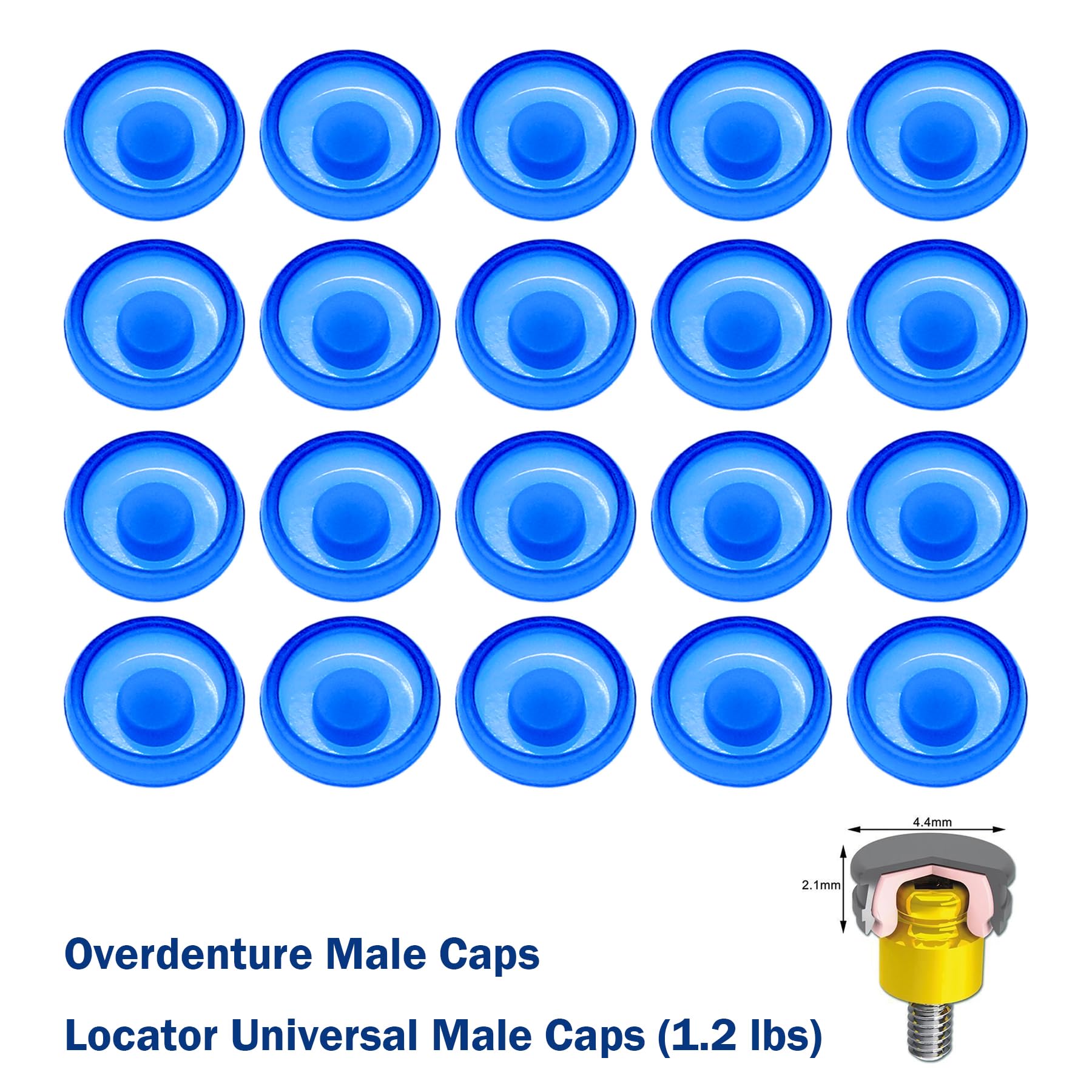 20 Pcs Overdenture Retention Caps 1.2 lbs(20 Pcs 1.2 lbs Blue)