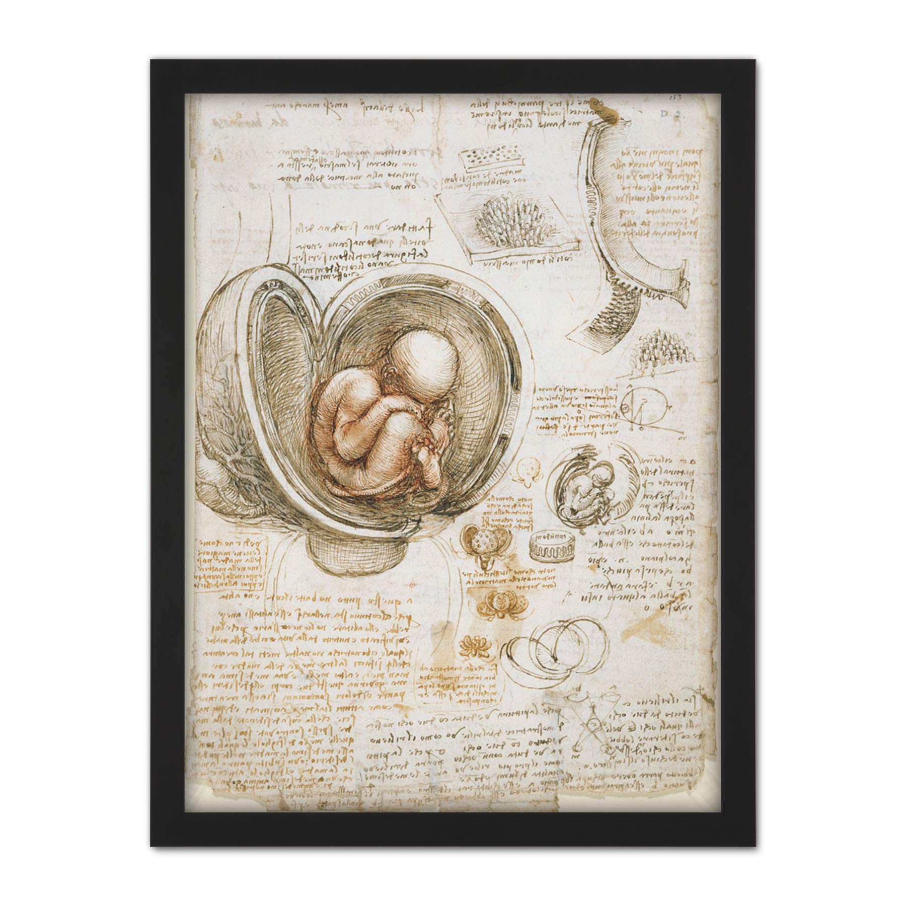 Artery8 Leonardo Da Vinci Studies Of The Foetus In Womb Artwork Framed Wall Art Print 18X24 Inch
