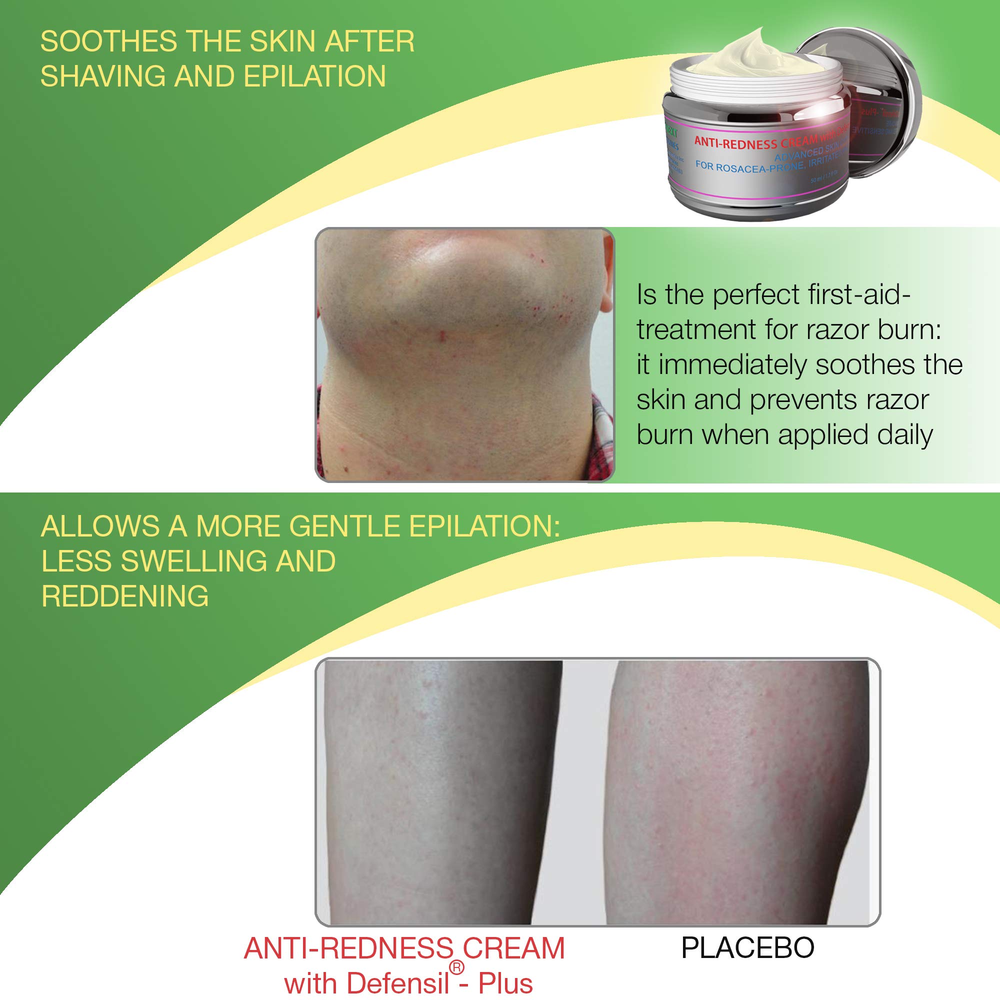 Redness Relief Face Eczema Cream AllNatural Anti Itch Cream Fast
