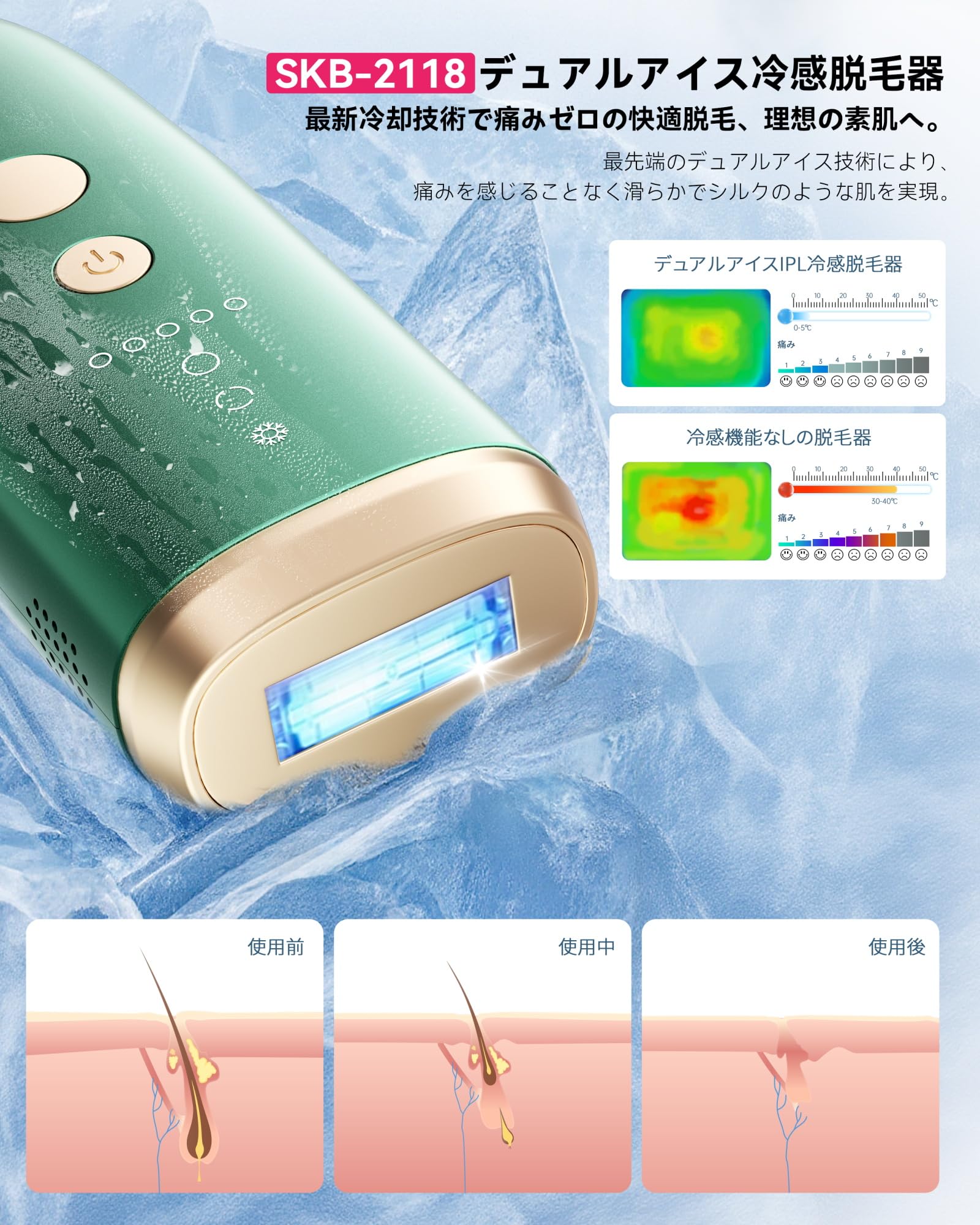 Amazon | YUNDOO 脱毛器 サロン級冷感無痛 【2025革新的連射冷却