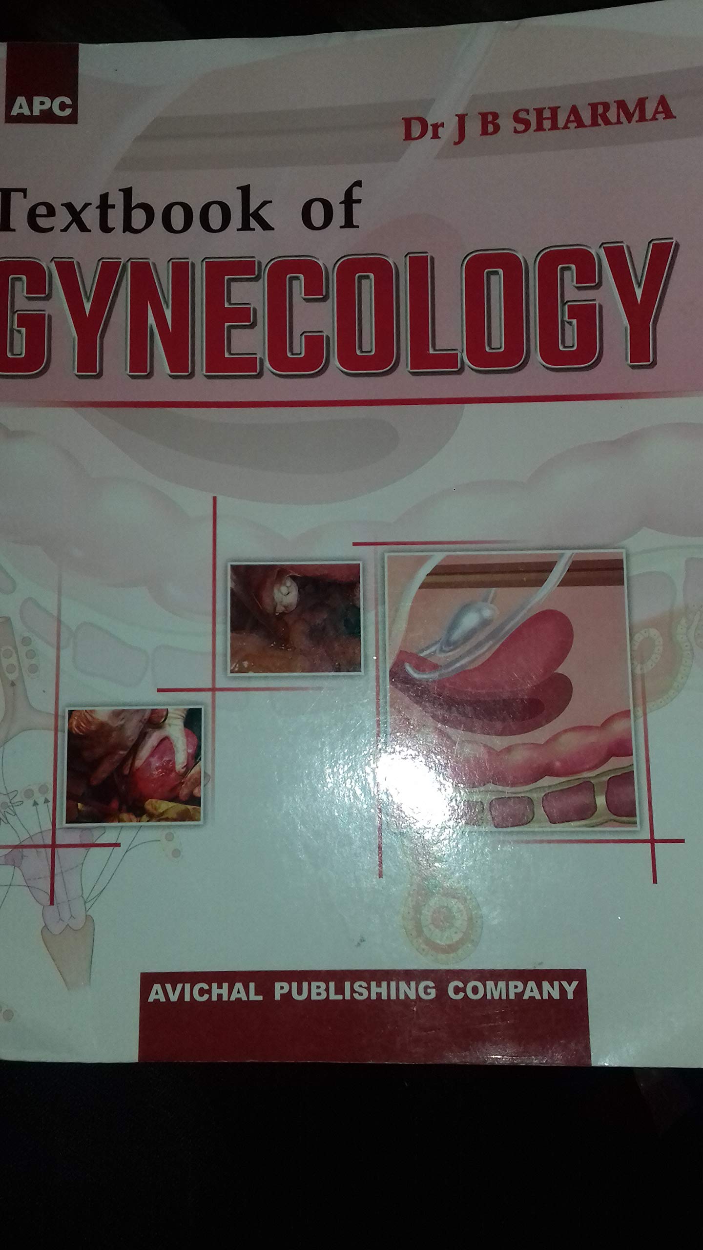 Textbook Of Gynecology