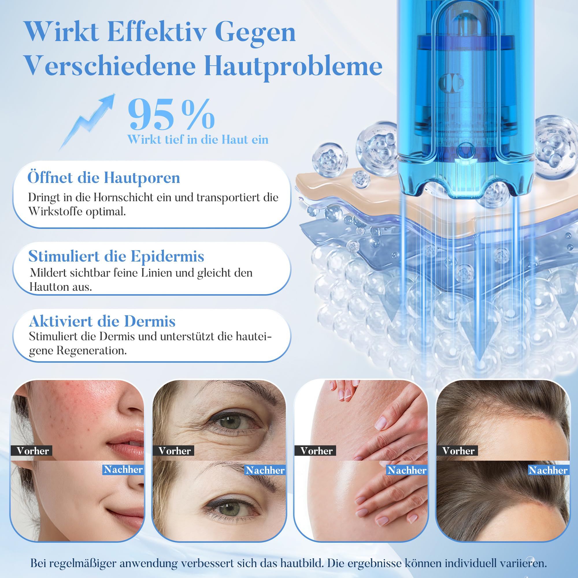 Dr. Pen 2026 Neuestes M9 Professioneller Microneedling Pen, Kabellos Dermapen, Upgrade Intelligenter Automatischer Tiefenanpassung und Chip Identifikation für Gesicht, Körper(inkl.10 Ersatzkartuschen)