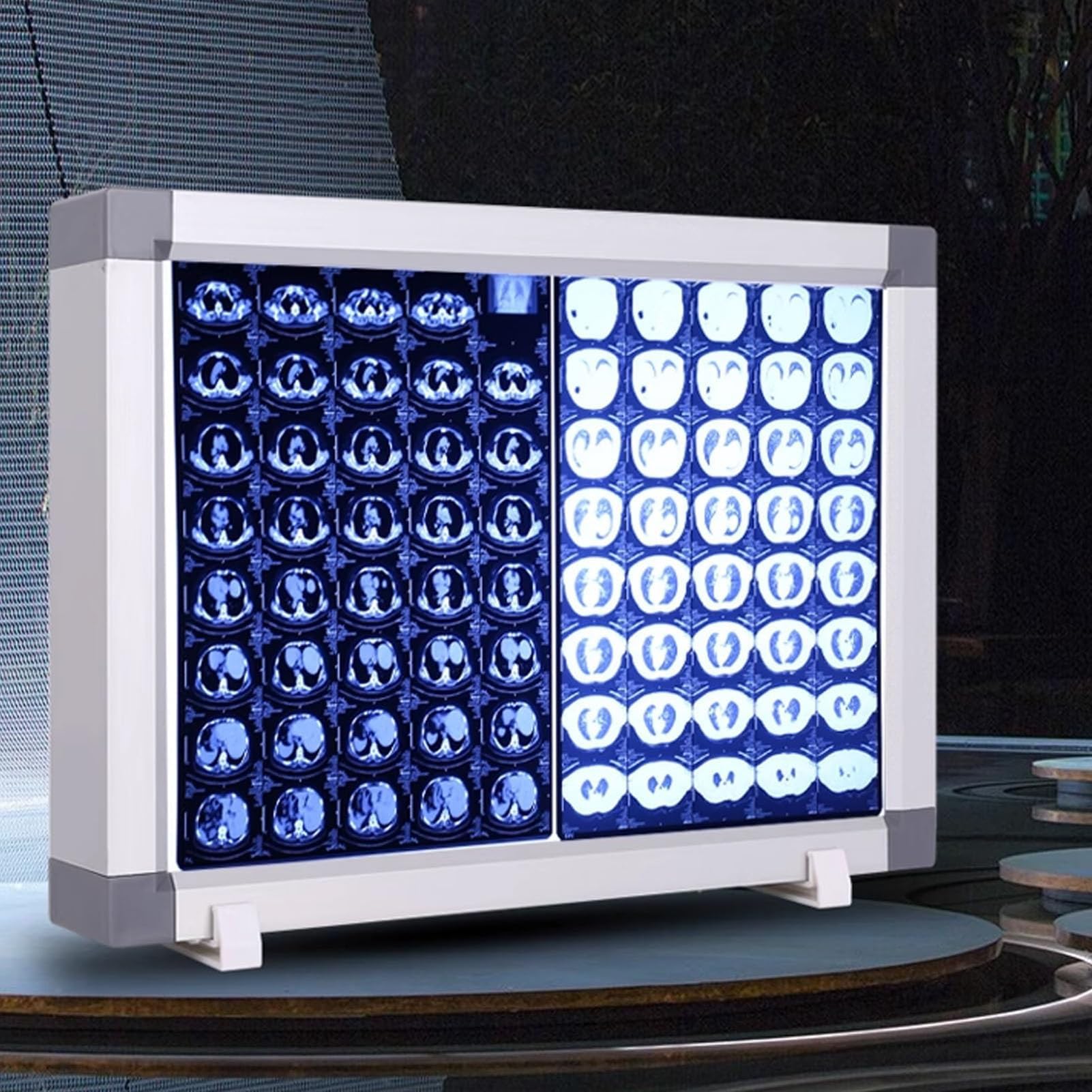 Négatoscope Radiographie LED Portable, Luminosité Réglable, Visionneuse de Film Médical, Panneau Acrylique et Cadre en Aluminium, Montage Mural ou Vertical