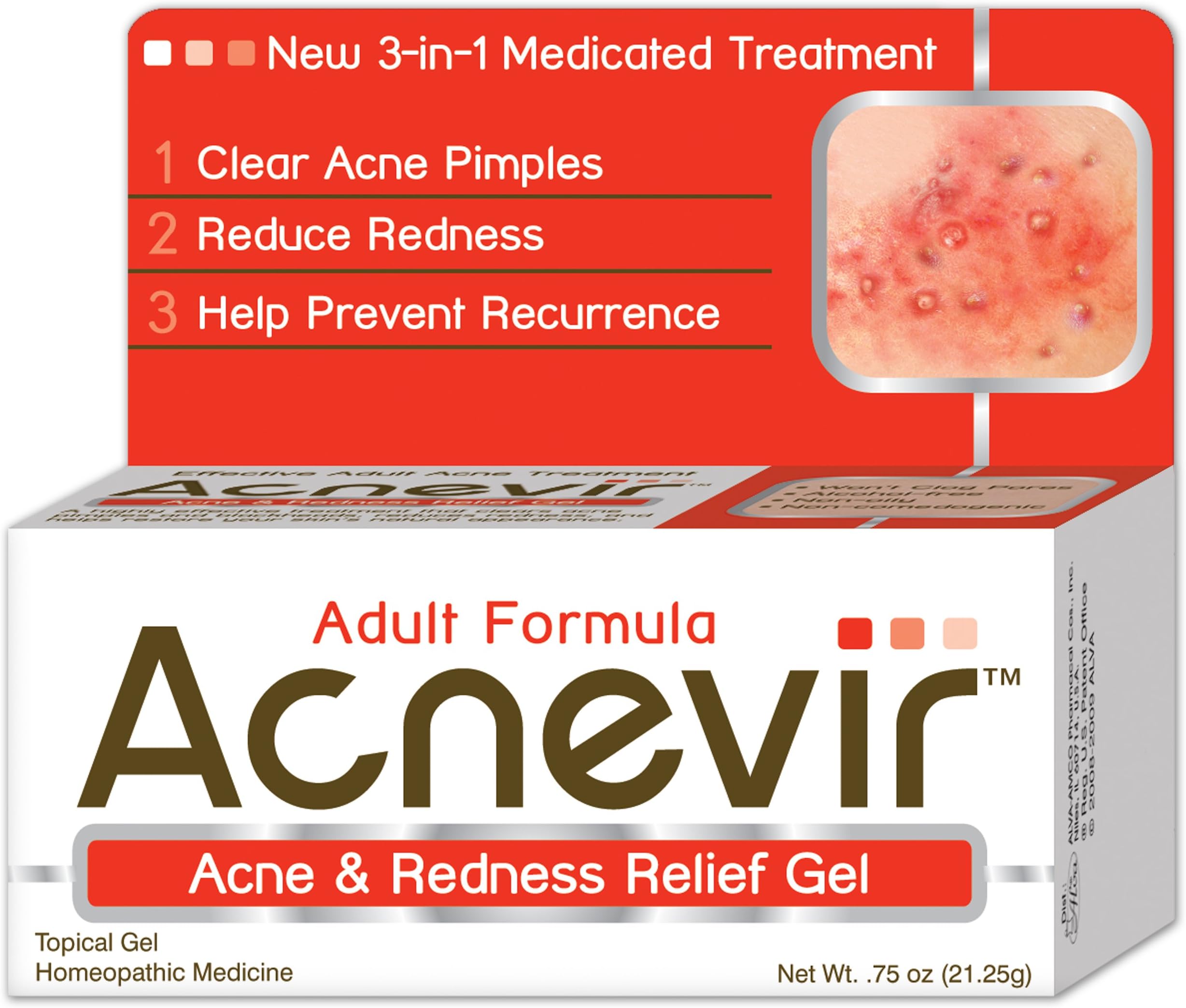 Acne and Redness Relief Gel, 0.75 Ounce Boxes (Pack of 3)